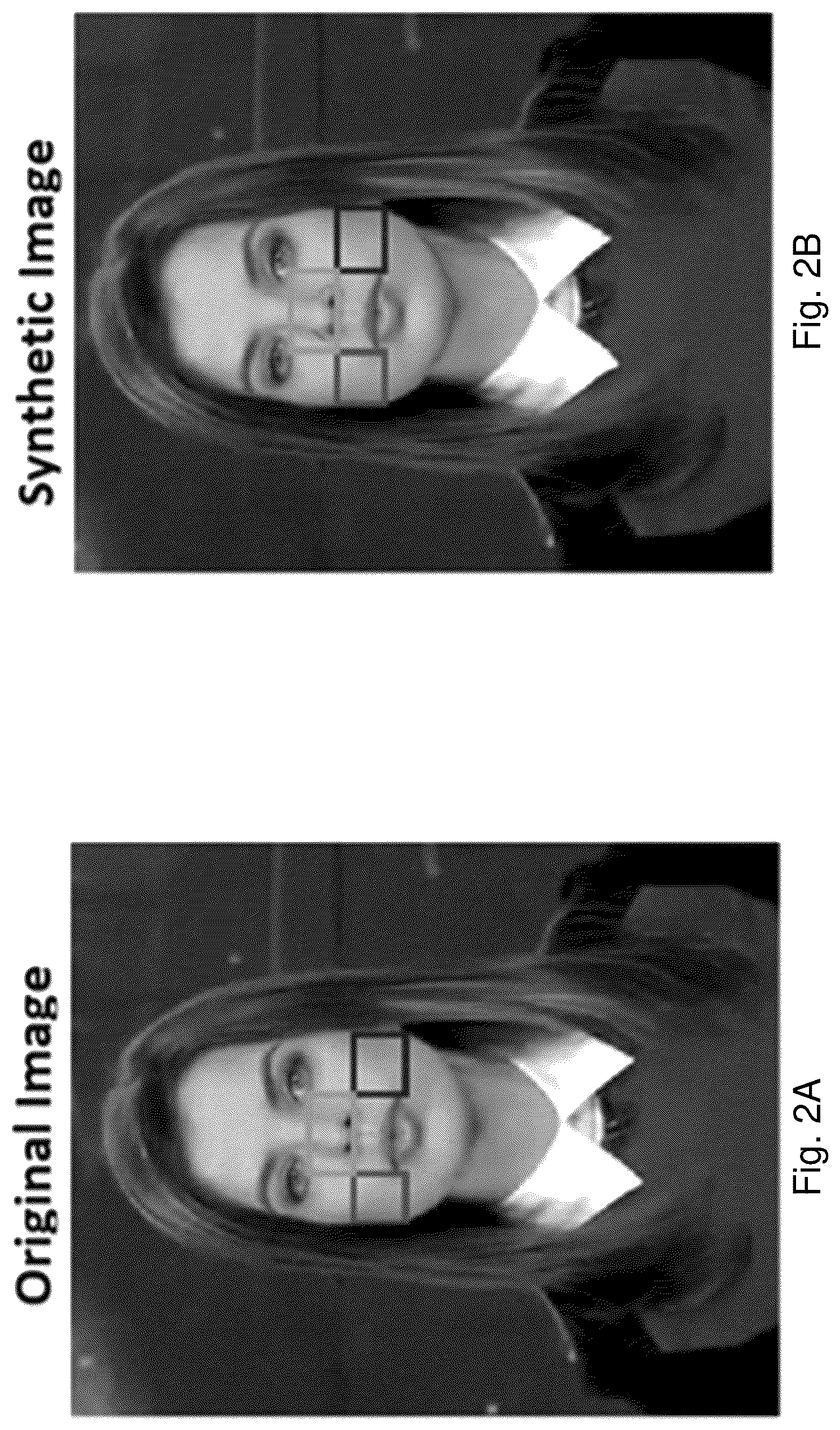 Patent US12106216 Figure 2 – Fakecatcher: detection of synthetic portrait videos using biological signals