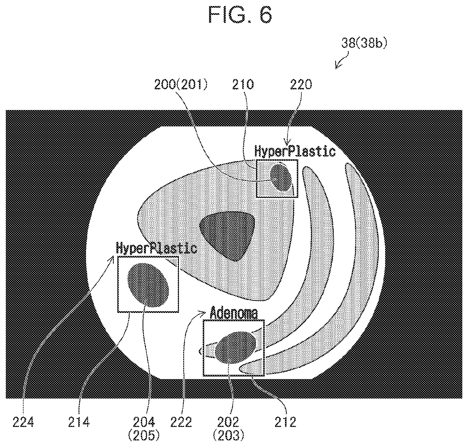 Patent US12106394 Figure 6 – Medical image processing apparatus, processor device, endoscope system, medical image processing method, and program