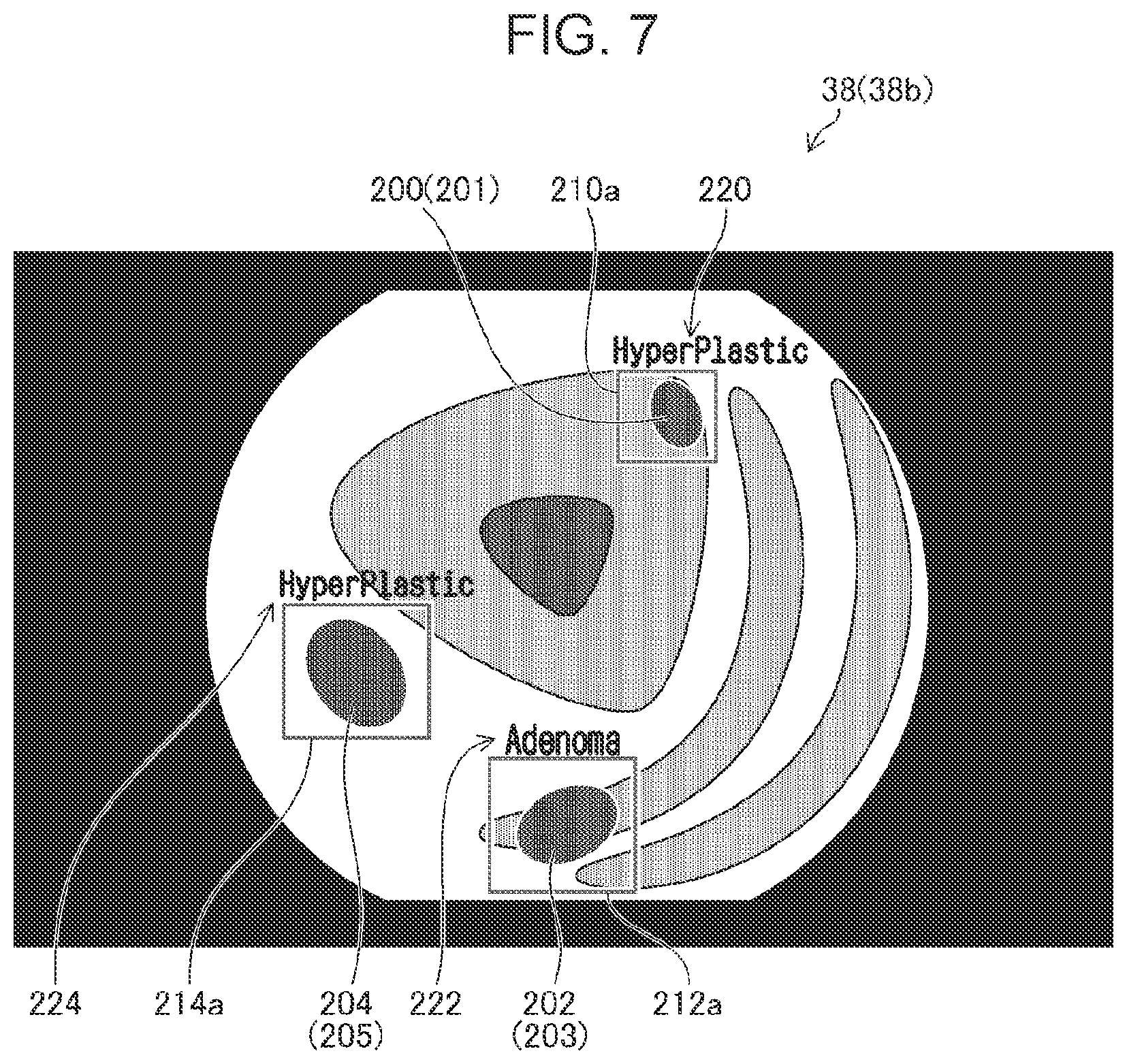 Patent US12106394 Figure 7 – Medical image processing apparatus, processor device, endoscope system, medical image processing method, and program