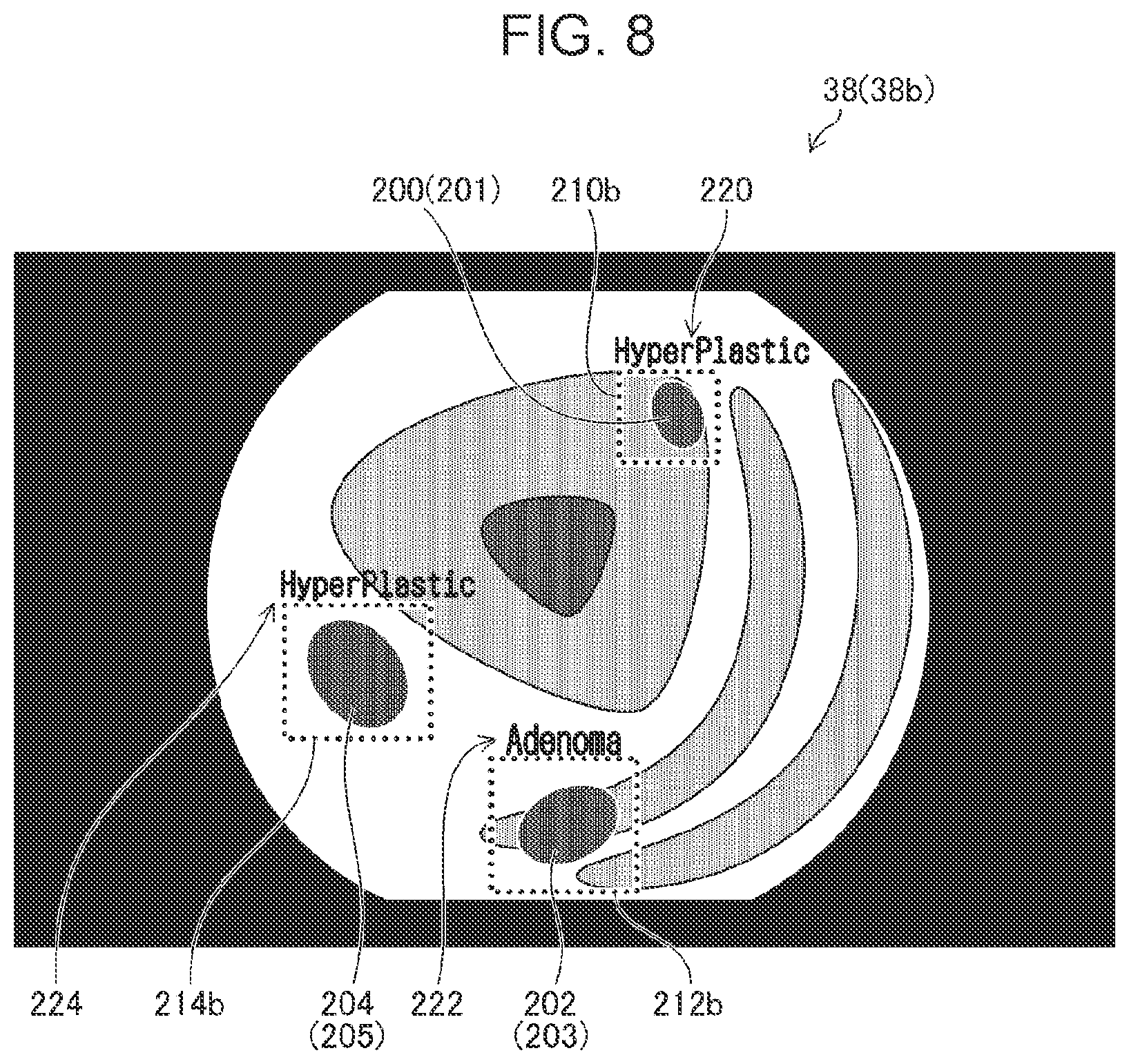 Patent US12106394 Figure 8 – Medical image processing apparatus, processor device, endoscope system, medical image processing method, and program