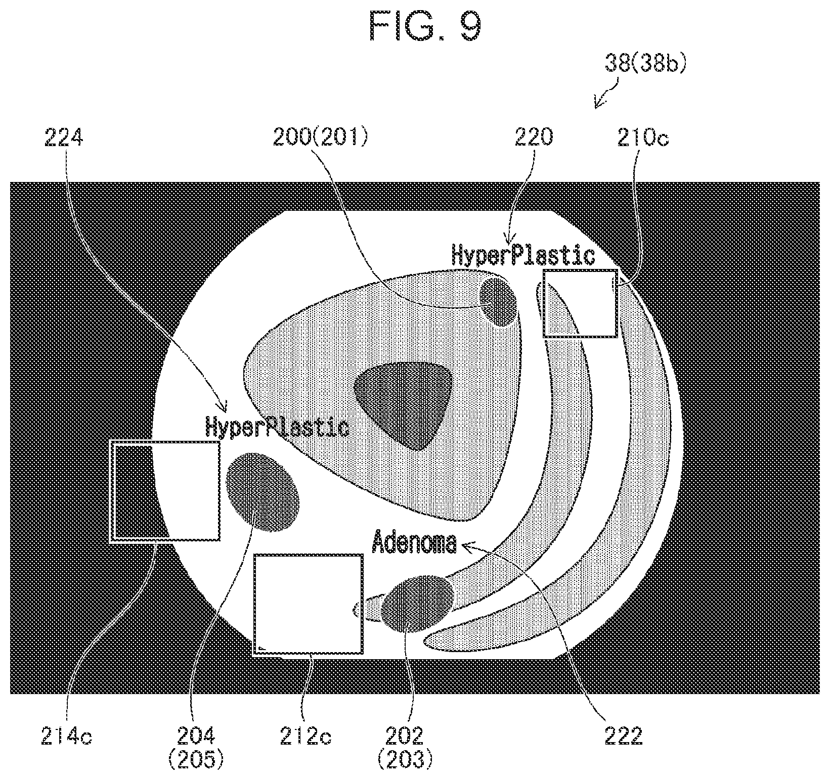Patent US12106394 Figure 9 – Medical image processing apparatus, processor device, endoscope system, medical image processing method, and program