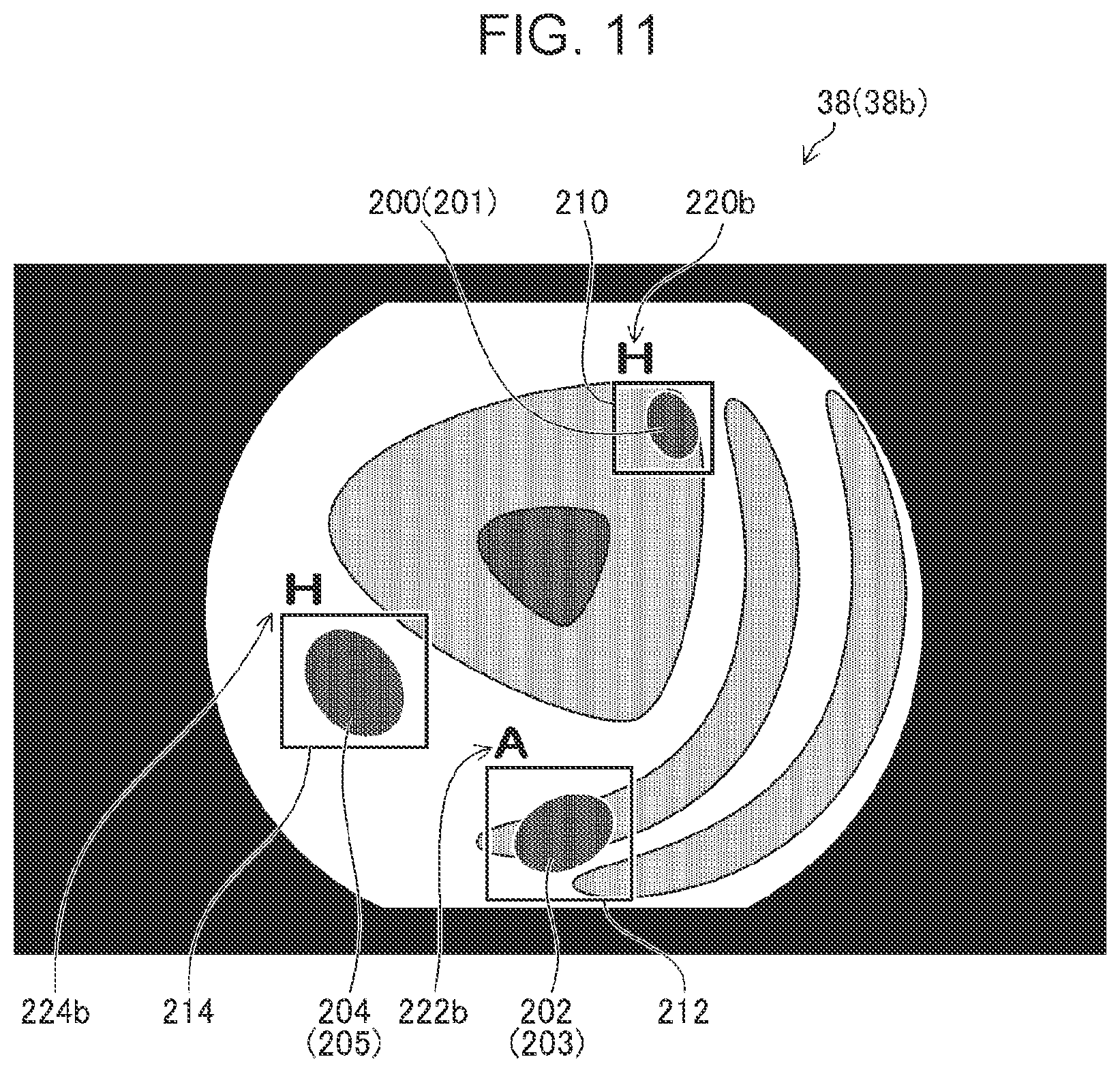Patent US12106394 Figure 11 – Medical image processing apparatus, processor device, endoscope system, medical image processing method, and program
