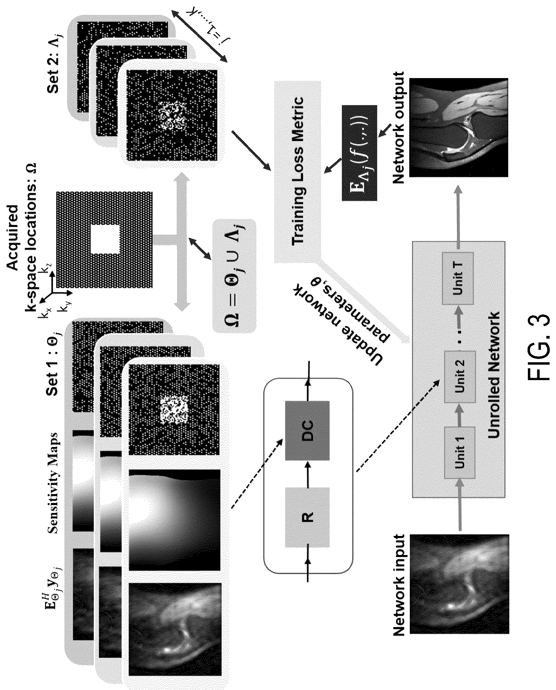 Patent US12106401 Figure 3 – Systems and methods for training machine learning algorithms for inverse problems without fully sampled reference data