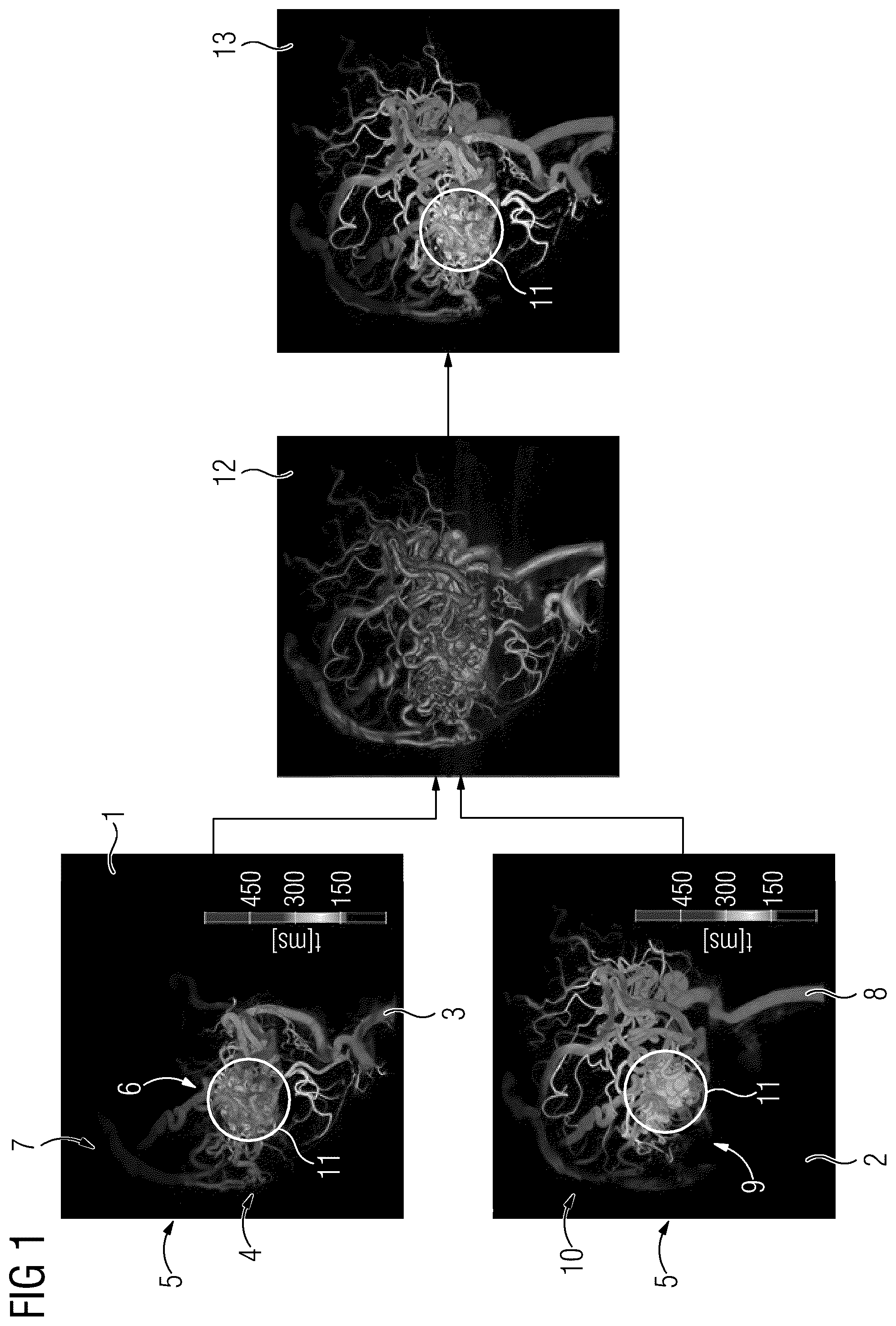 Patent US12106449 — Spatiotemporal fusion of time-resolved angiographic data sets — Figure 1