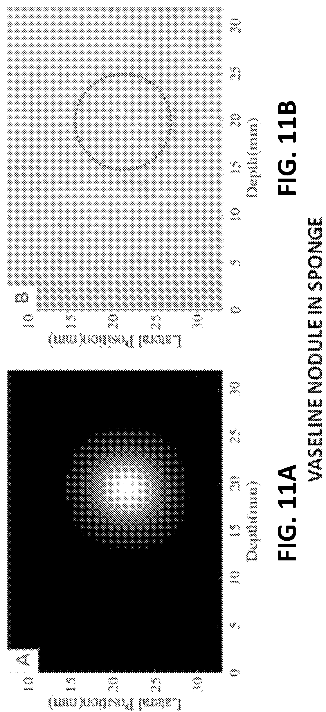 Patent US12106470 Figure 11 – Lesion detection and localization in heterogeneous media