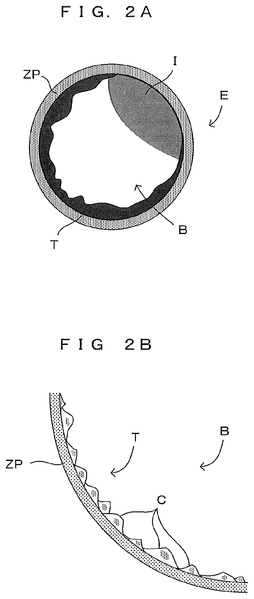 Patent US12106471 Figure 2 – Image processing method for imaging a cell aggregate and recording medium therefor