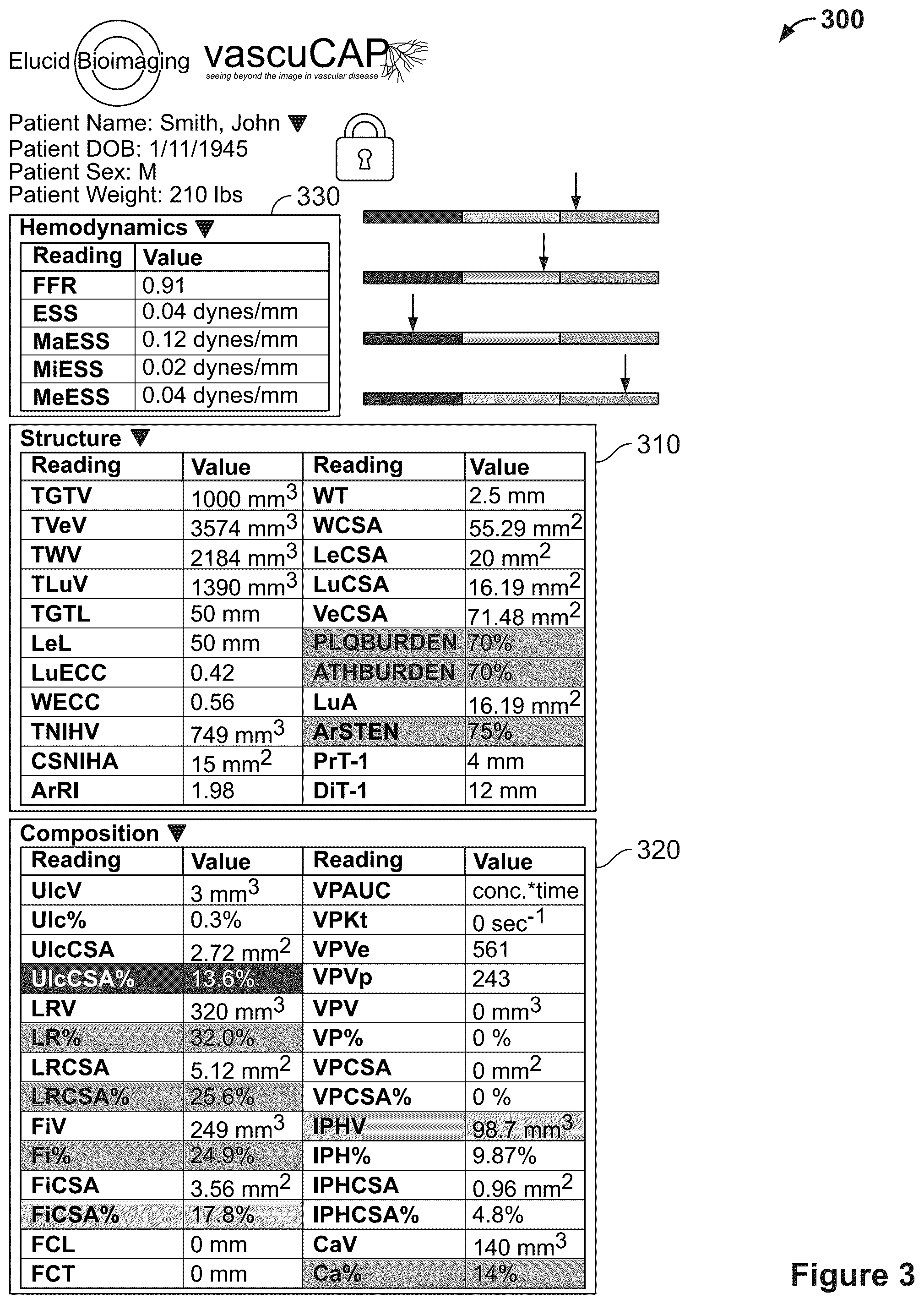 Patent US12106477 Figure 2 – Segmenting permeability, neovascularization, necrosis, collagen breakdown, or inflammation to characterize atherosclerotic plaque, coronary artery disease, or vasculopathy