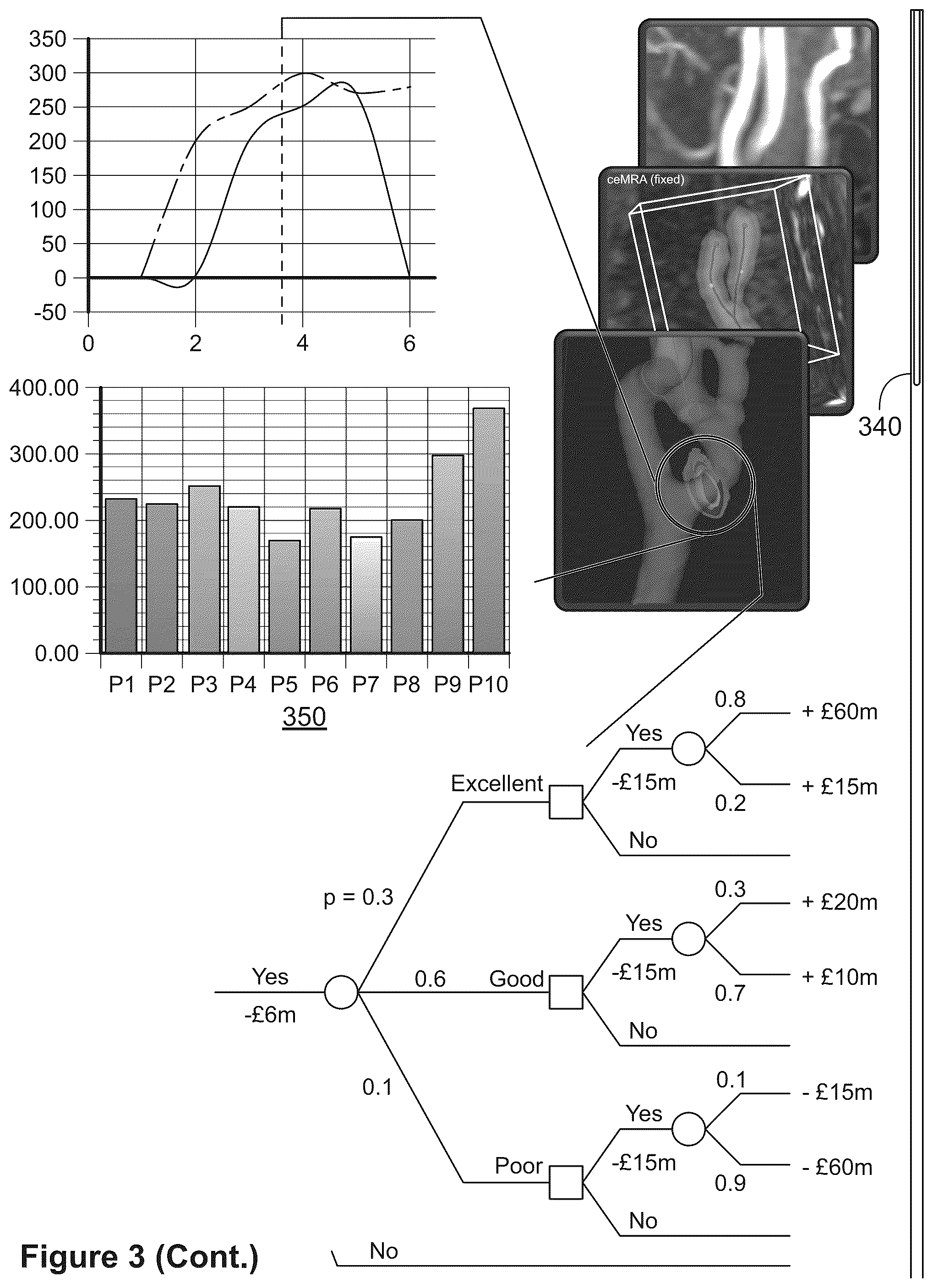 Patent US12106477 Figure 3 – Segmenting permeability, neovascularization, necrosis, collagen breakdown, or inflammation to characterize atherosclerotic plaque, coronary artery disease, or vasculopathy