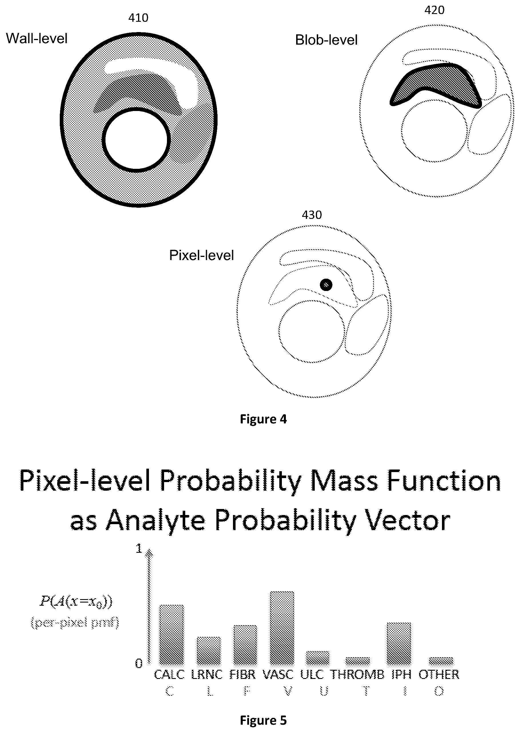 Patent US12106477 Figure 4 – Segmenting permeability, neovascularization, necrosis, collagen breakdown, or inflammation to characterize atherosclerotic plaque, coronary artery disease, or vasculopathy