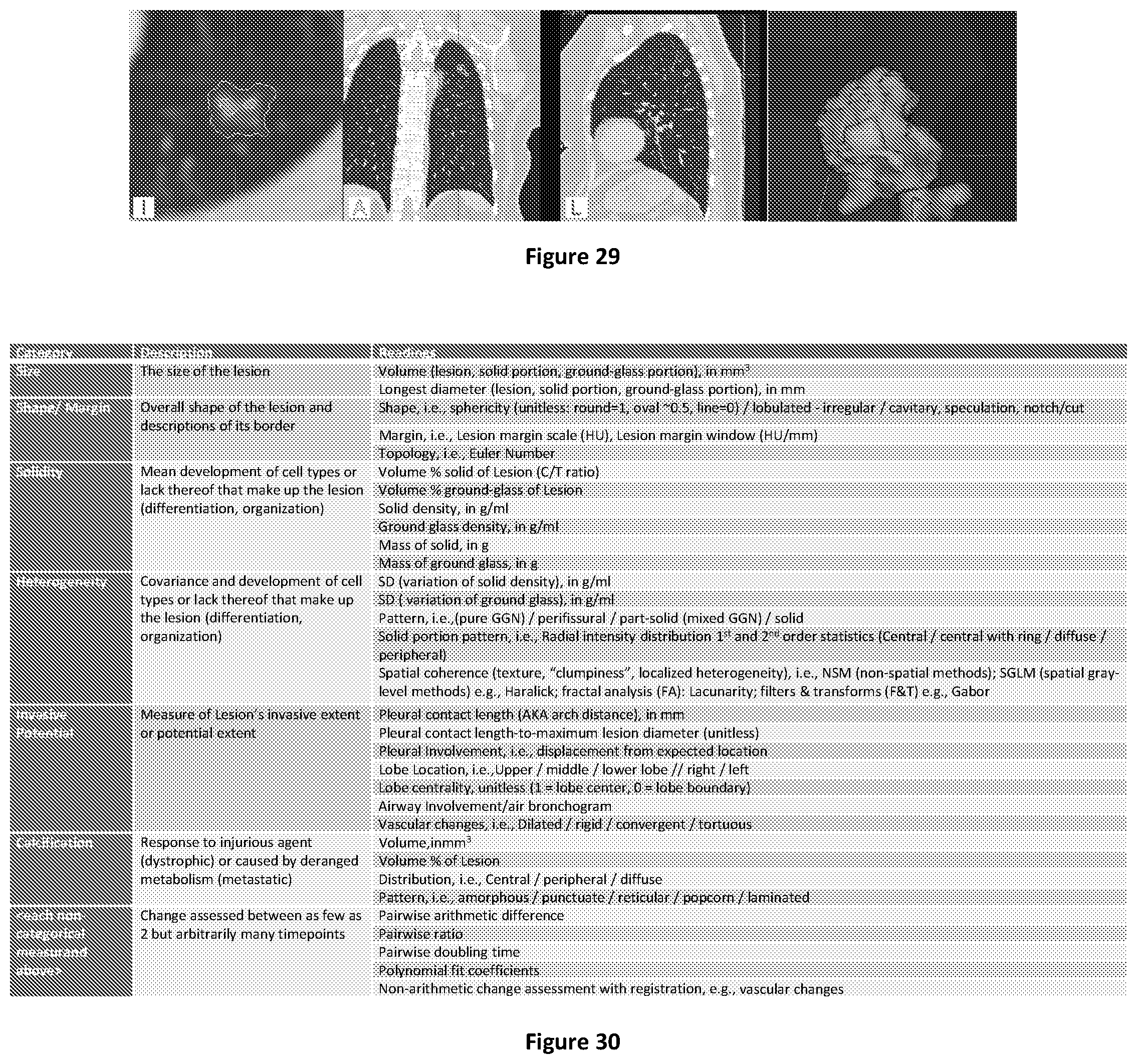 Patent US12106477 Figure 18 – Segmenting permeability, neovascularization, necrosis, collagen breakdown, or inflammation to characterize atherosclerotic plaque, coronary artery disease, or vasculopathy