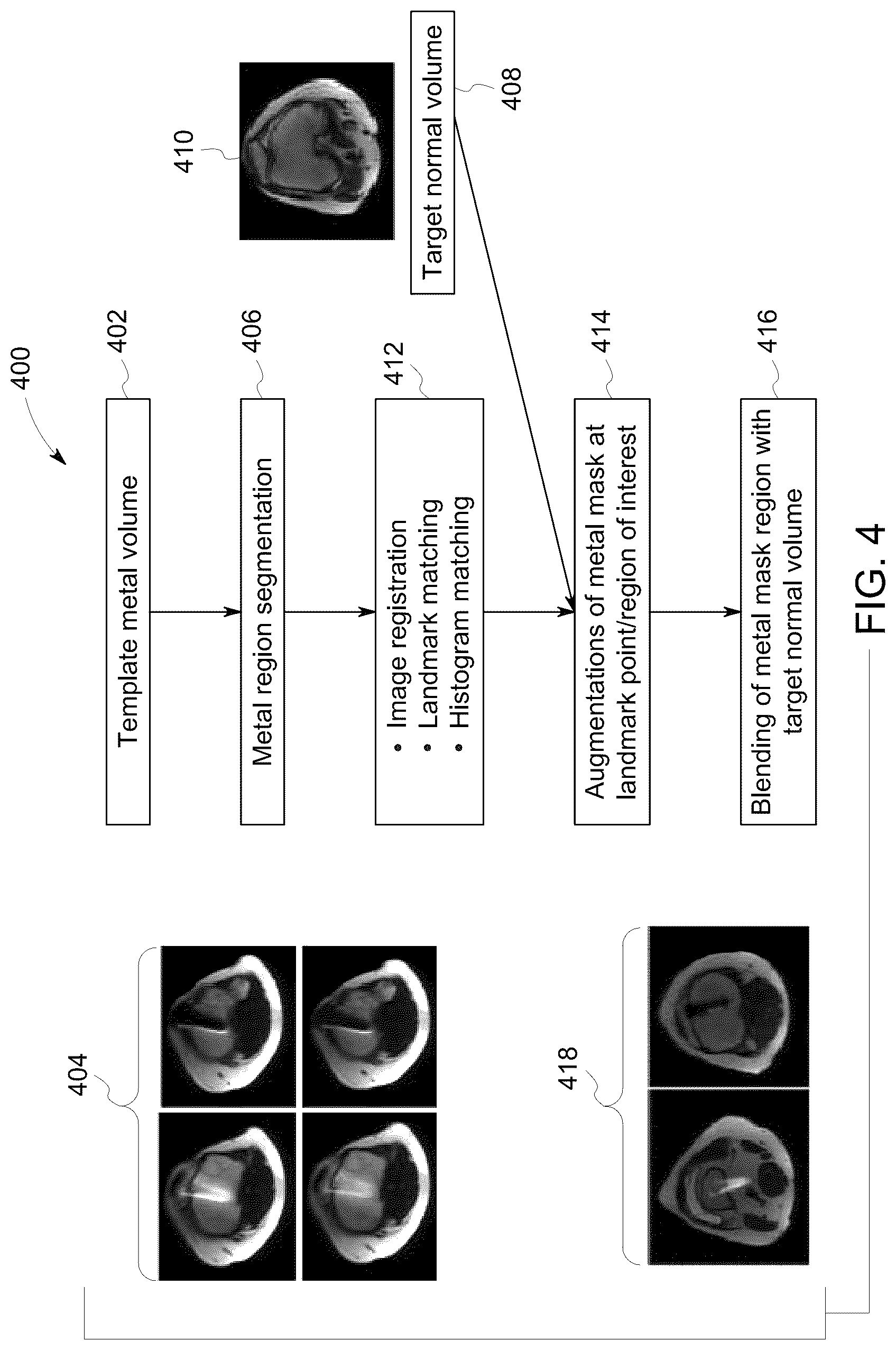 Patent US12106478 Figure 4 – Deep learning based medical system and method for image acquisition