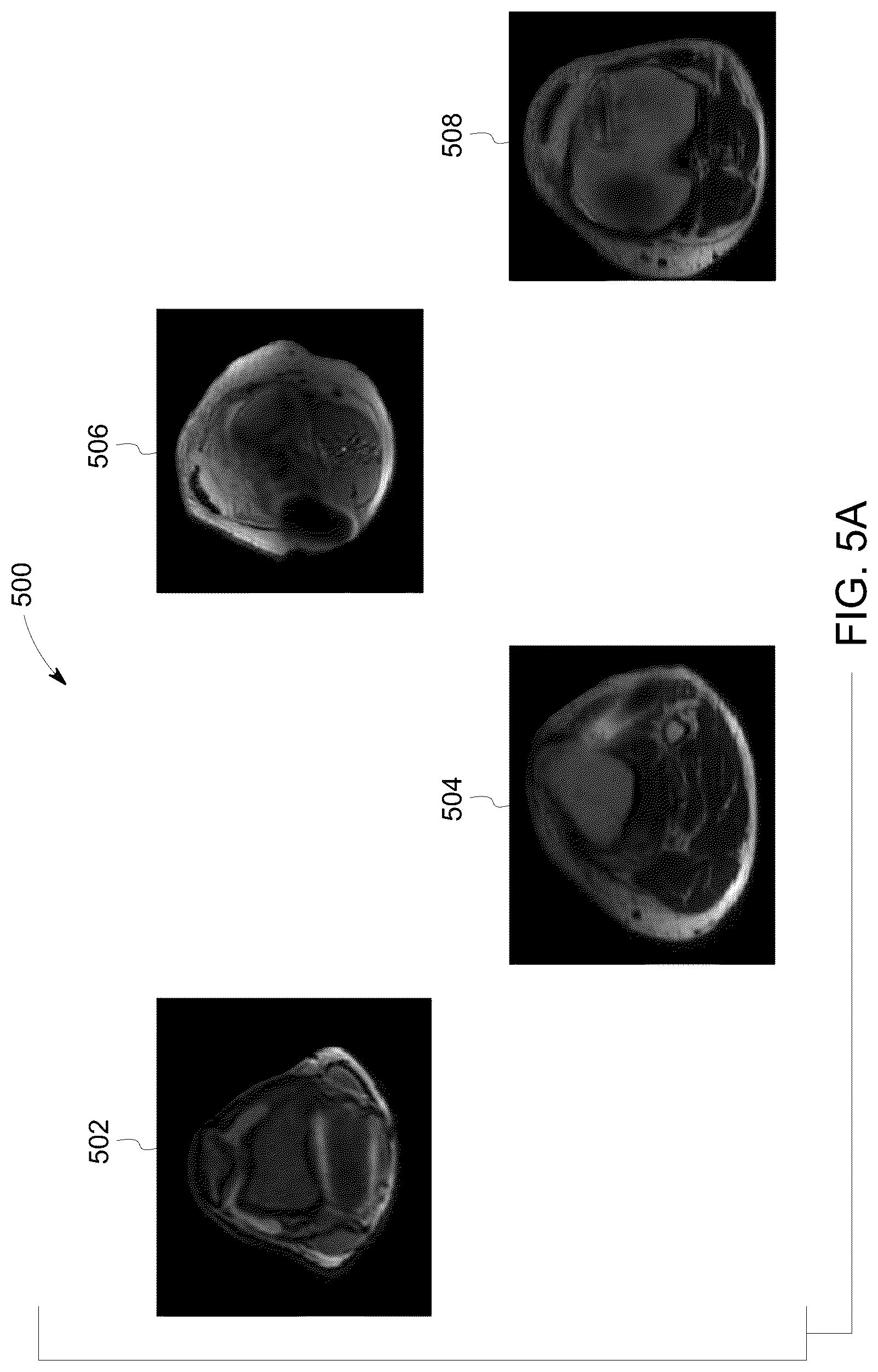 Patent US12106478 Figure 5 – Deep learning based medical system and method for image acquisition