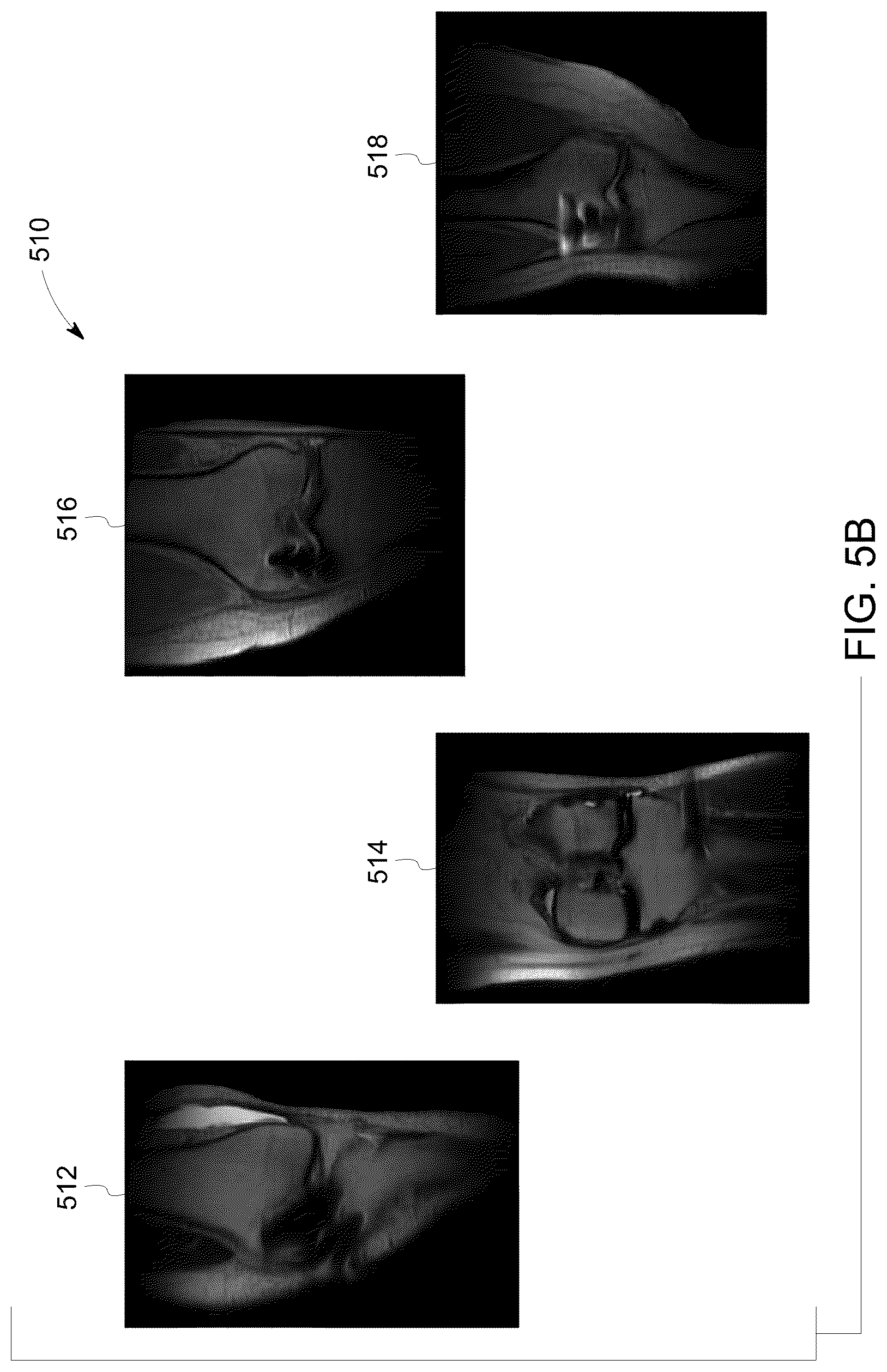 Patent US12106478 Figure 6 – Deep learning based medical system and method for image acquisition