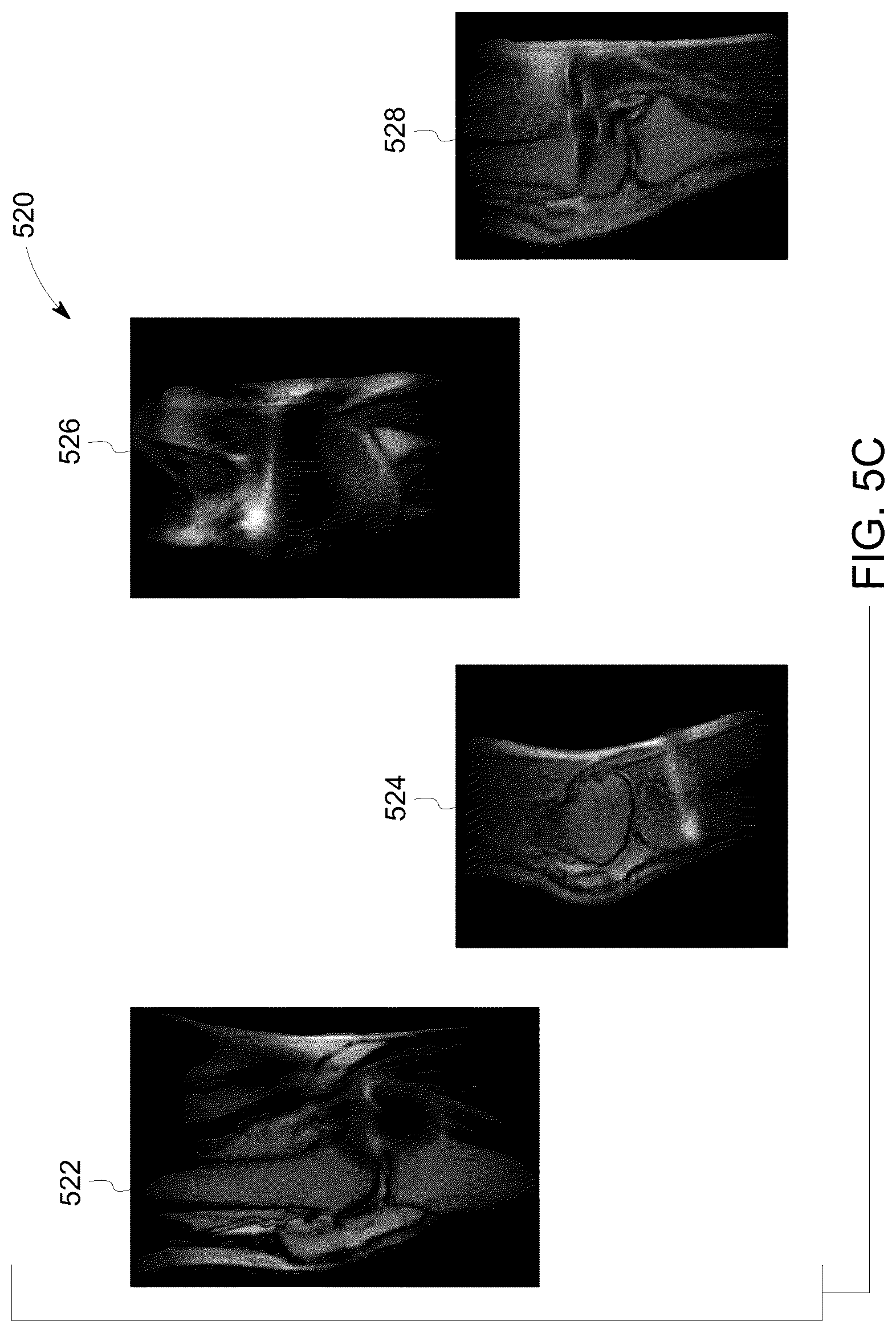 Patent US12106478 Figure 7 – Deep learning based medical system and method for image acquisition