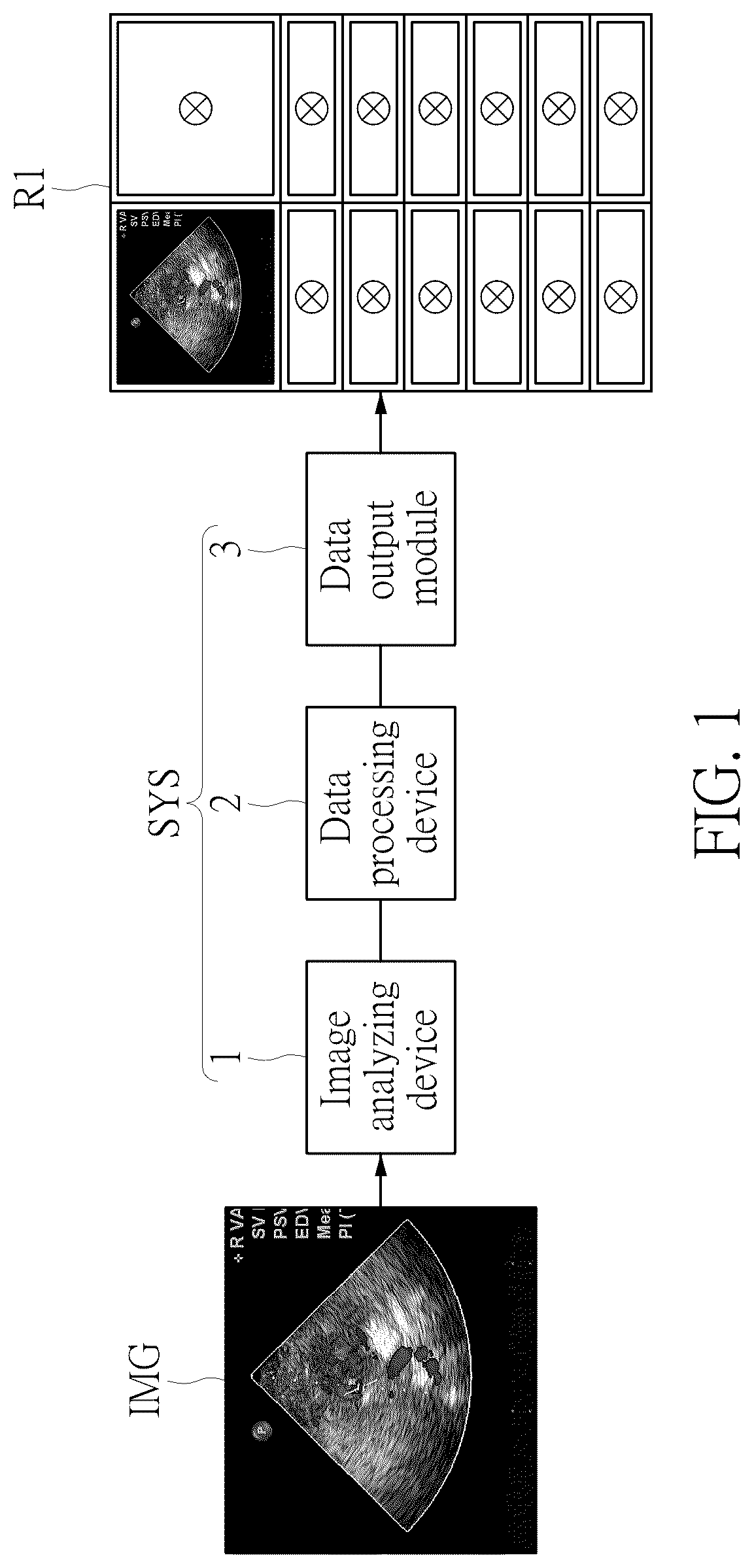 Patent US12106479 Figure 1 – Ultrasound image recognition system and data output module