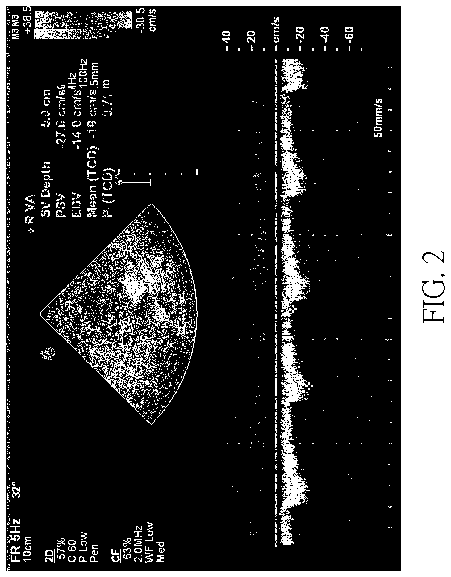 Patent US12106479 Figure 2 – Ultrasound image recognition system and data output module