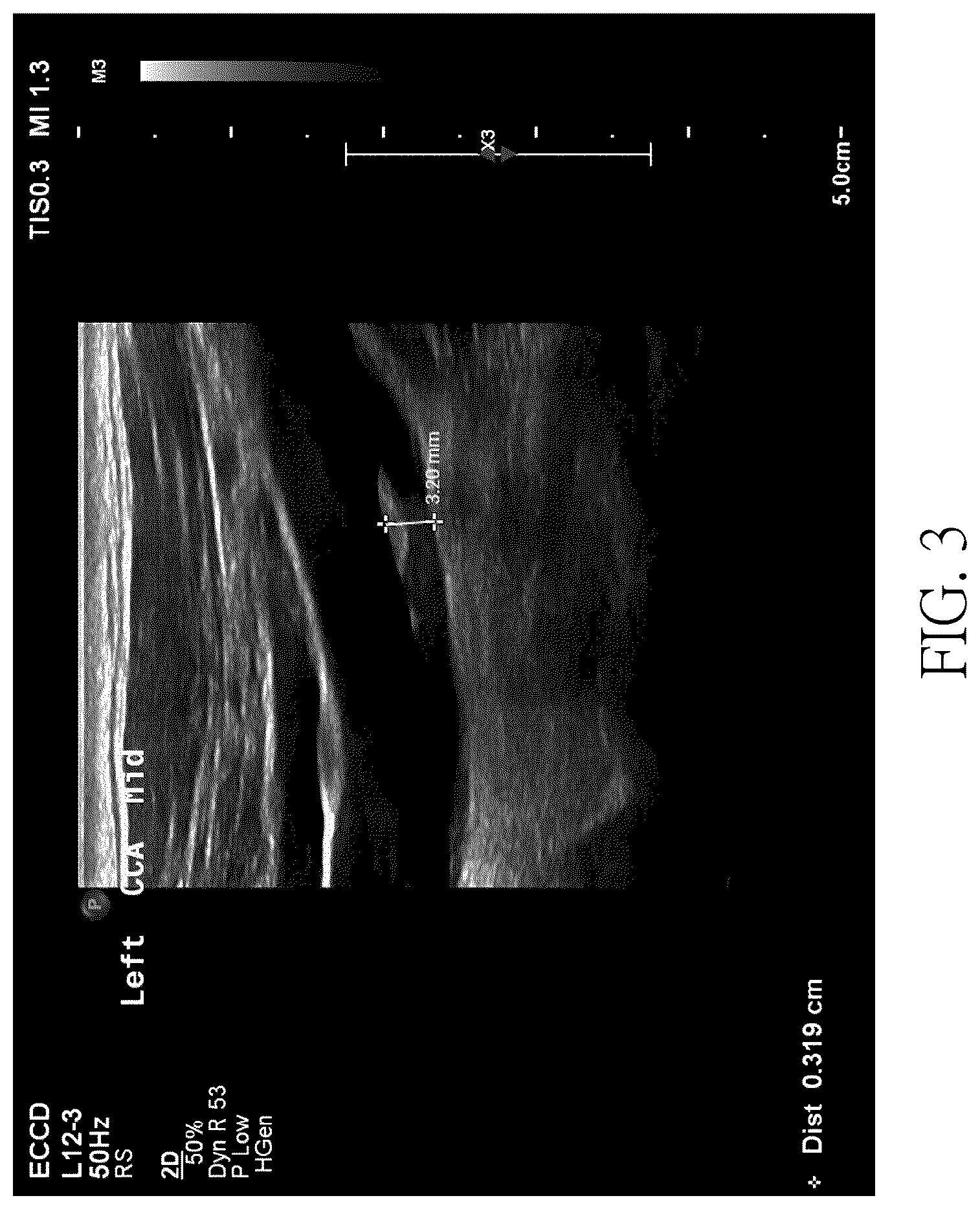 Patent US12106479 Figure 3 – Ultrasound image recognition system and data output module