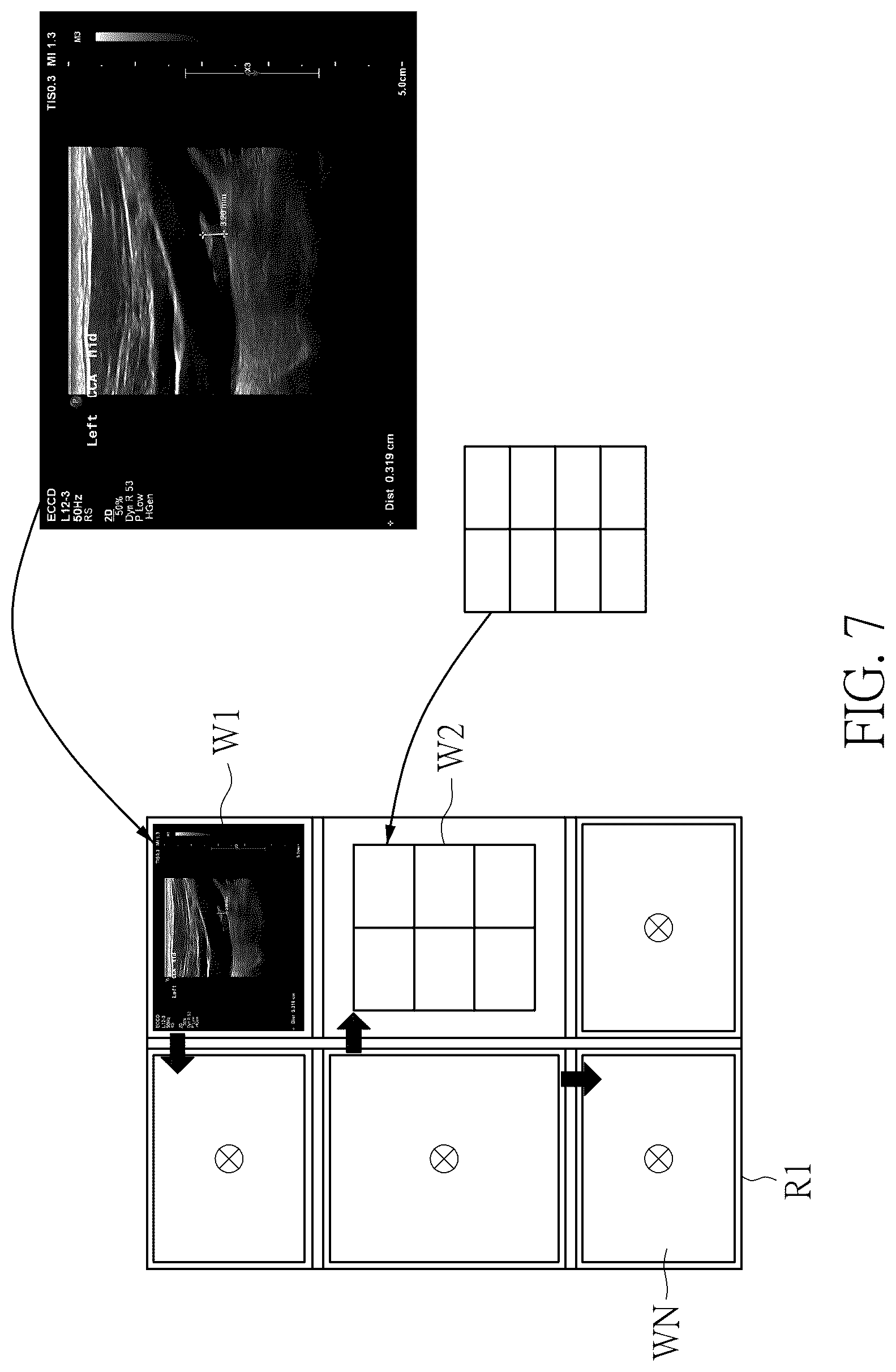 Patent US12106479 Figure 7 – Ultrasound image recognition system and data output module