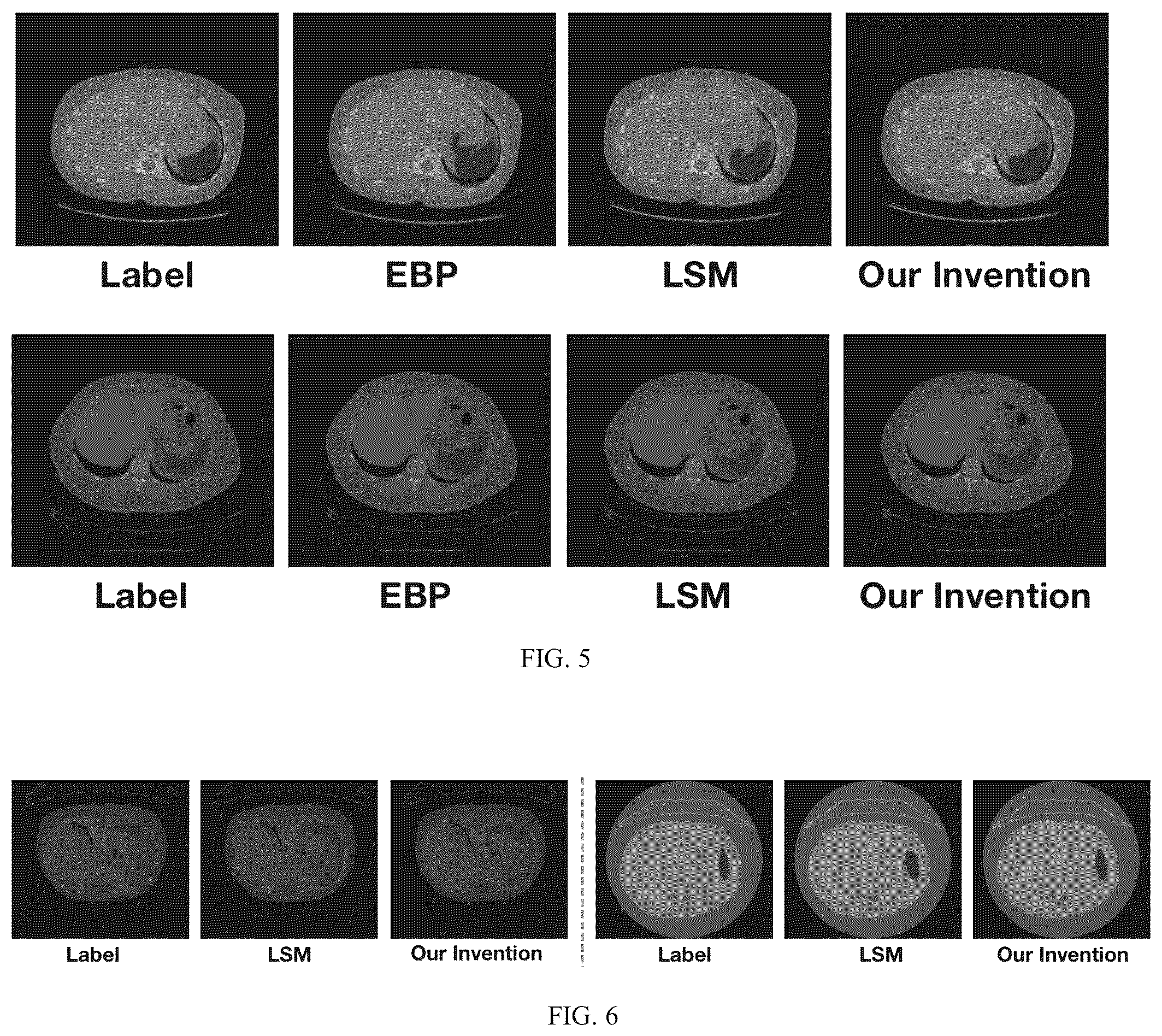 Patent US12106482 Figure 3 – Learning-based active surface model for medical image segmentation