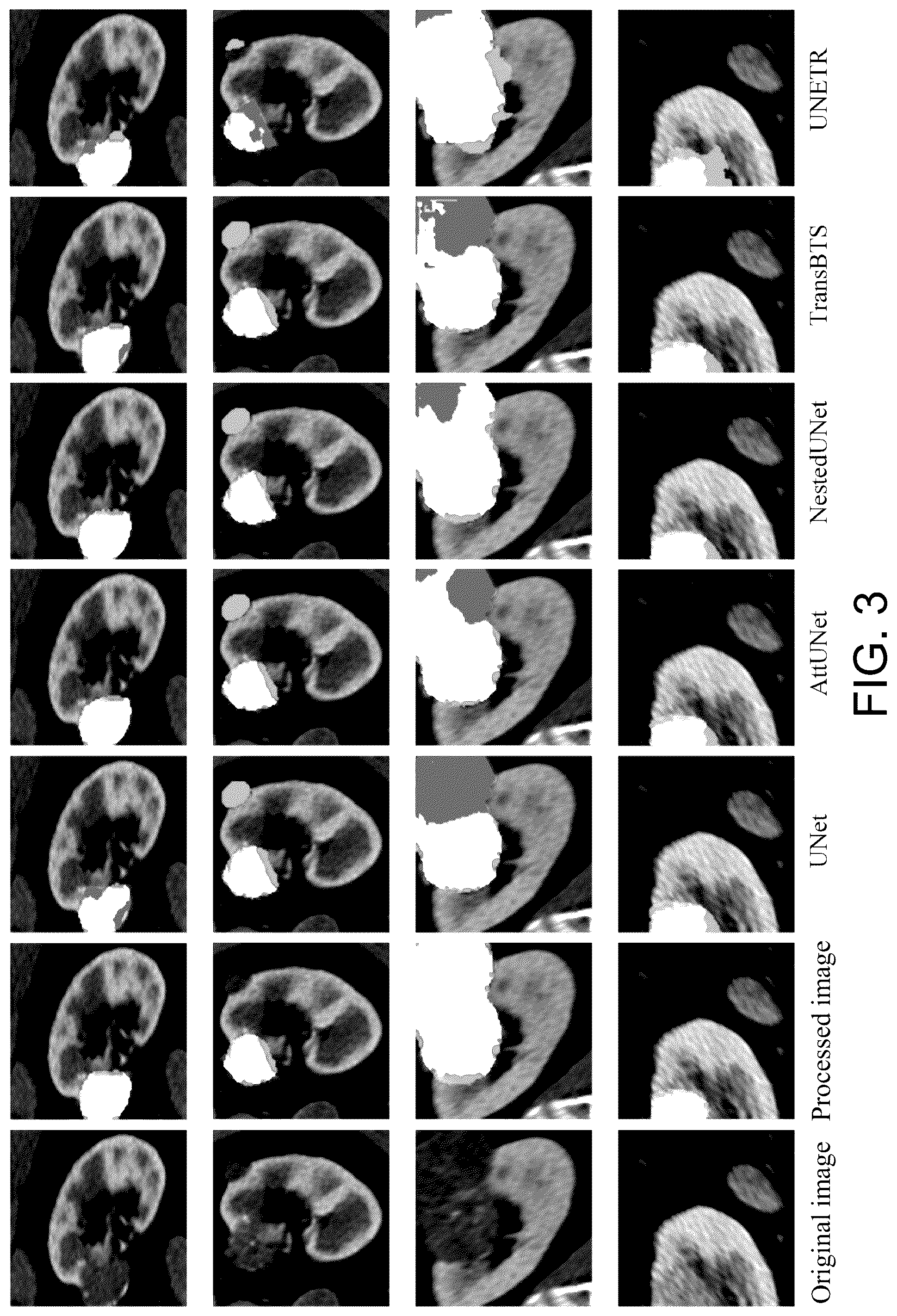 Patent US12106484 Figure 3 – Three-dimensional medical image segmentation method and system based on short-term and long-term memory self-attention model