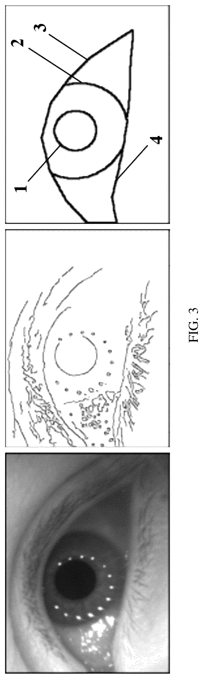 Patent US12106485 Figure 3 – Edge-guided human eye image analyzing method
