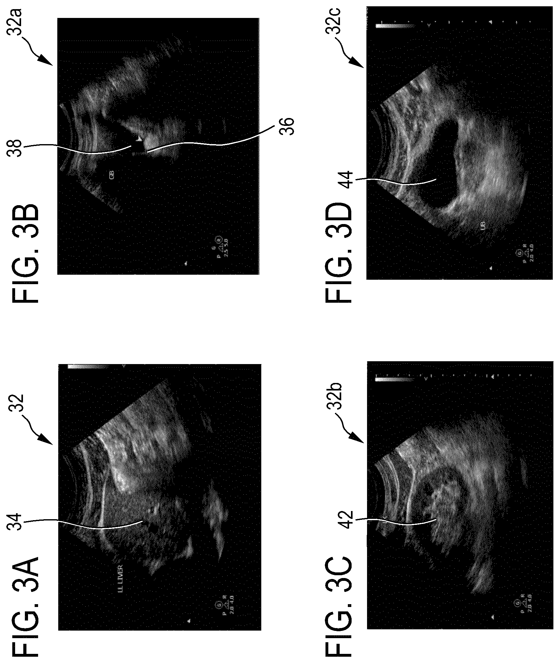 Patent US12106496 Figure 3 – Lower to higher resolution image fusion