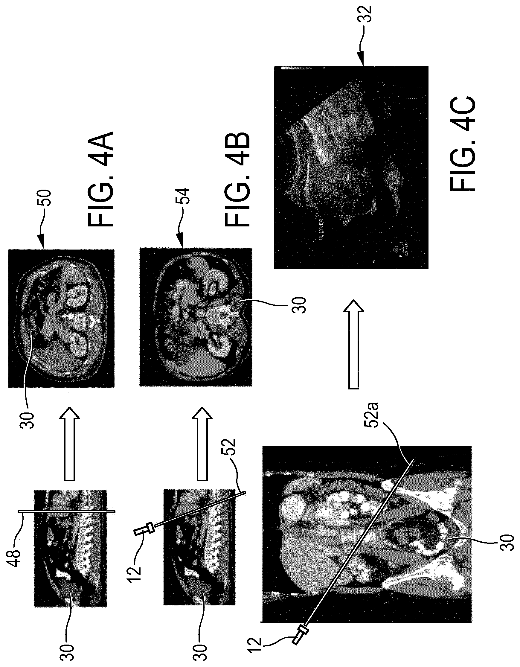 Patent US12106496 Figure 4 – Lower to higher resolution image fusion