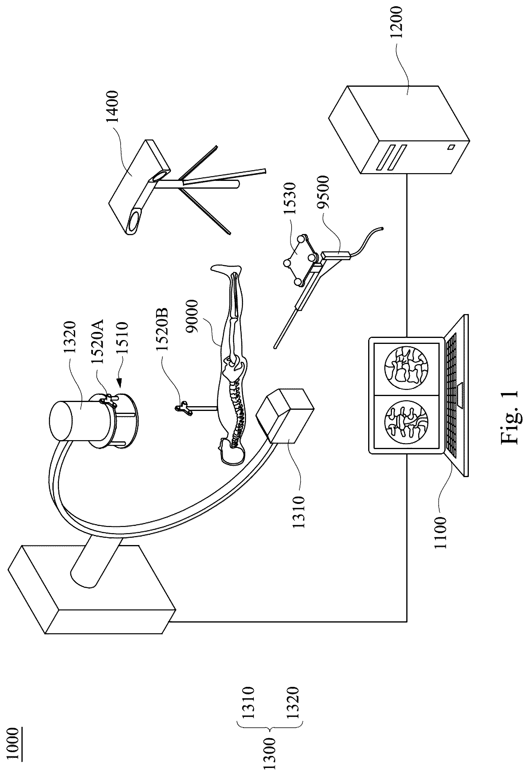 Patent US12106497 Figure 1 – Method and navigation system for registering two-dimensional image data set with three-dimensional image data set of body of interest
