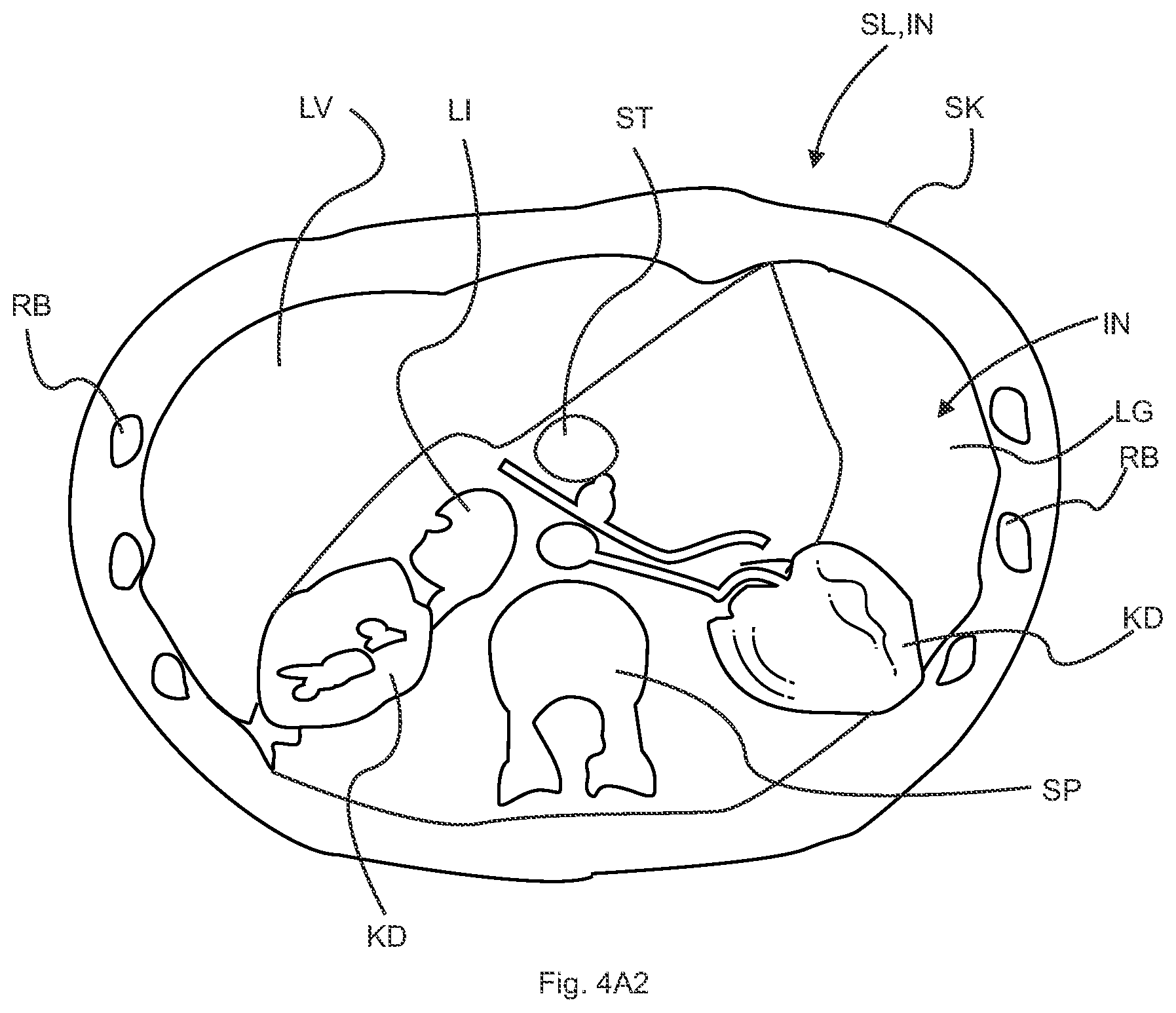 Patent US12106501 Figure 5 – Subsurface imaging and display of 3D digital image and 3D image sequence
