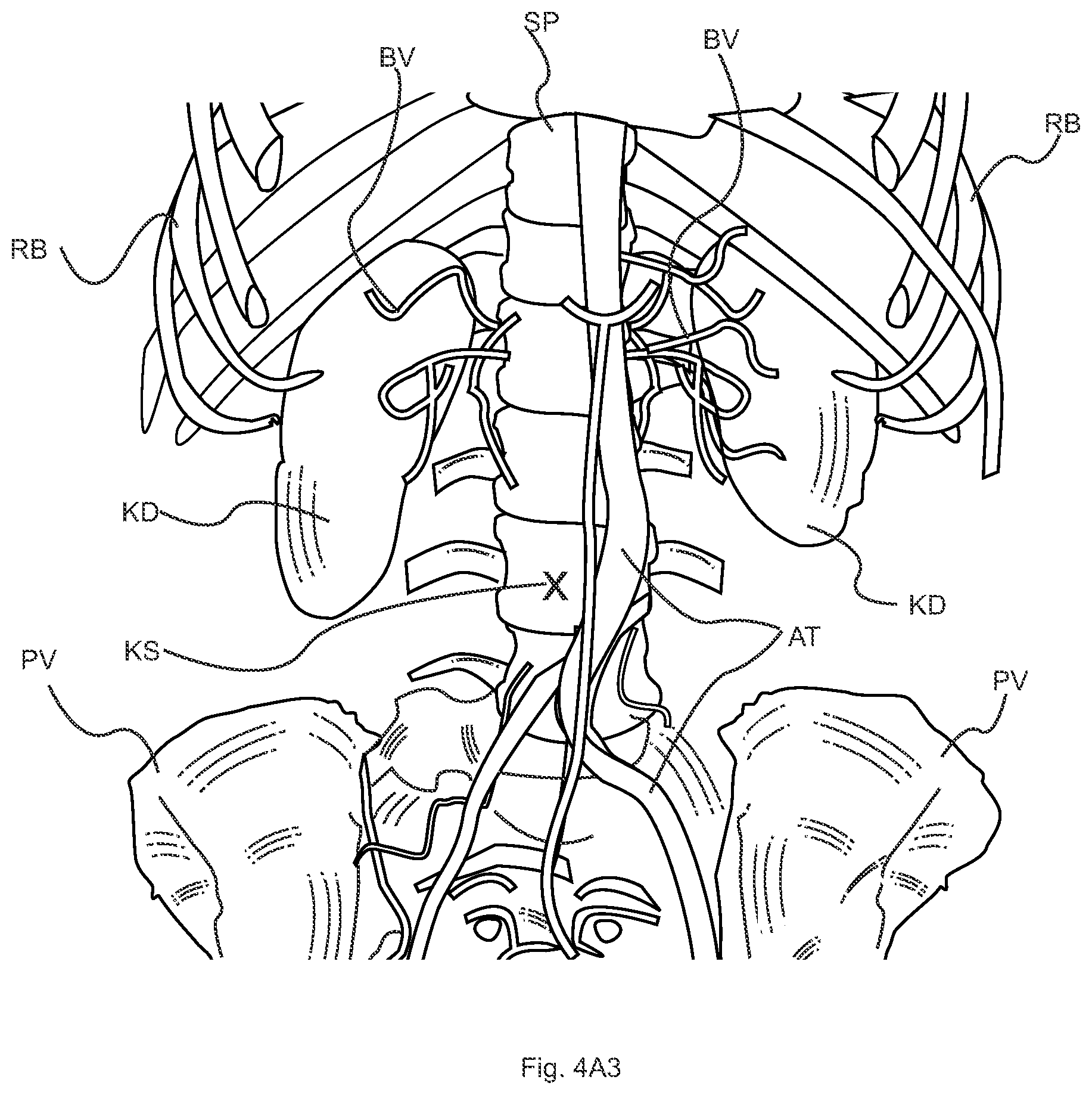 Patent US12106501 Figure 6 – Subsurface imaging and display of 3D digital image and 3D image sequence