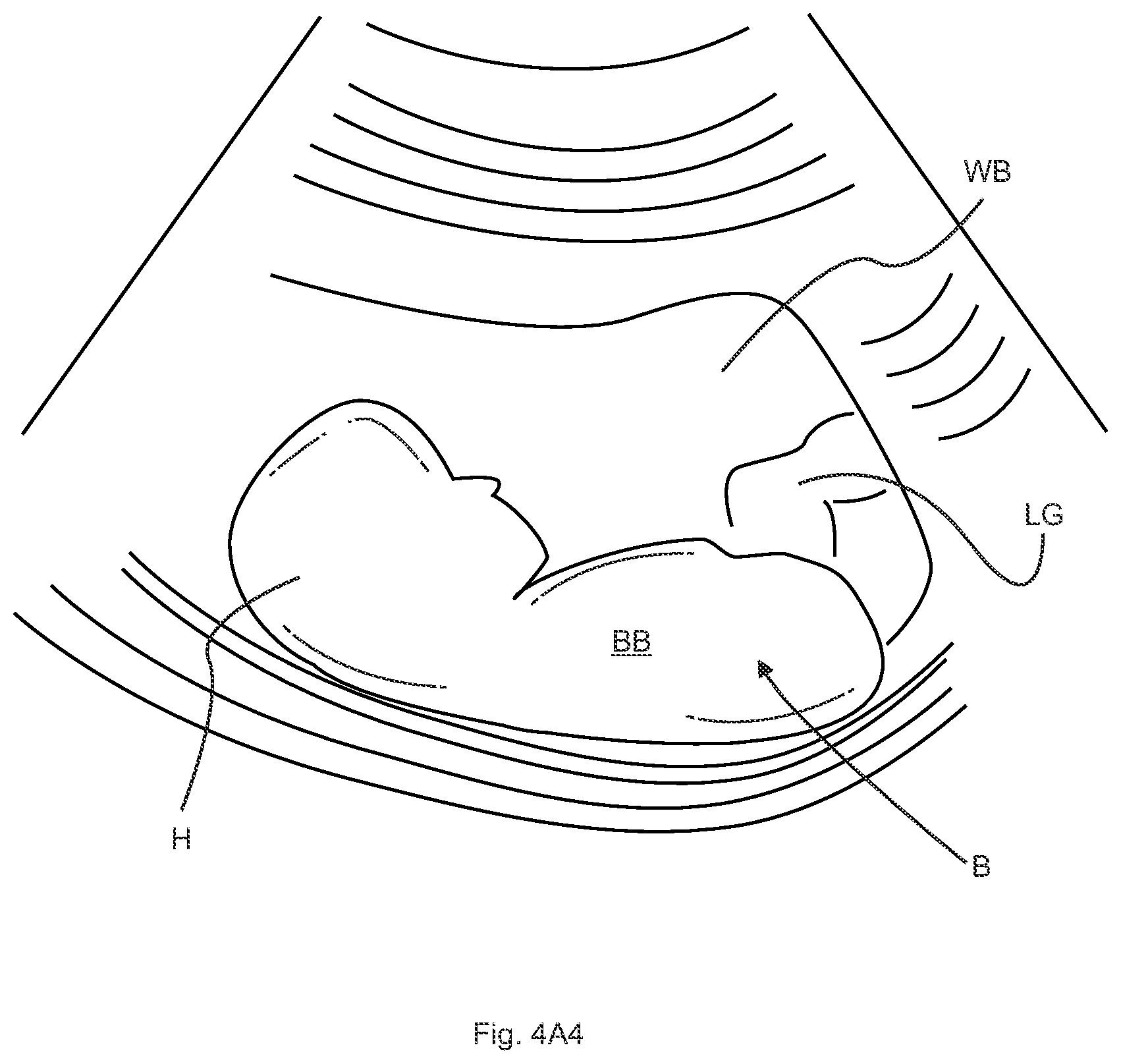 Patent US12106501 Figure 7 – Subsurface imaging and display of 3D digital image and 3D image sequence