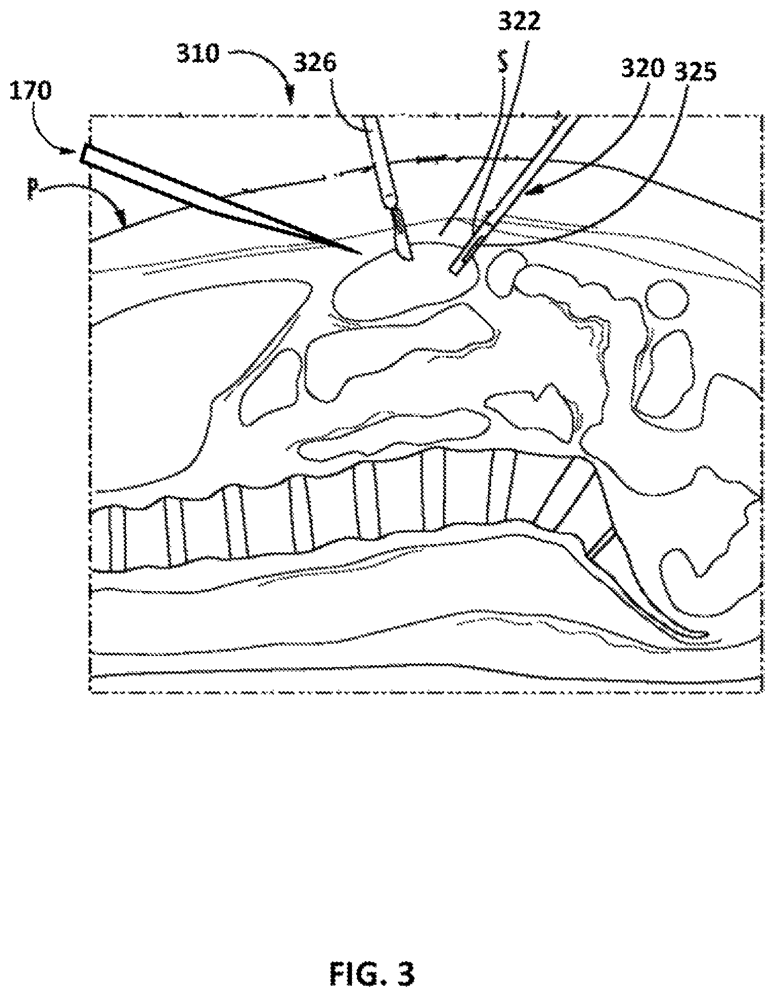 Patent US12106508 Figure 4 – Systems and methods for mitigating collision of a robotic system