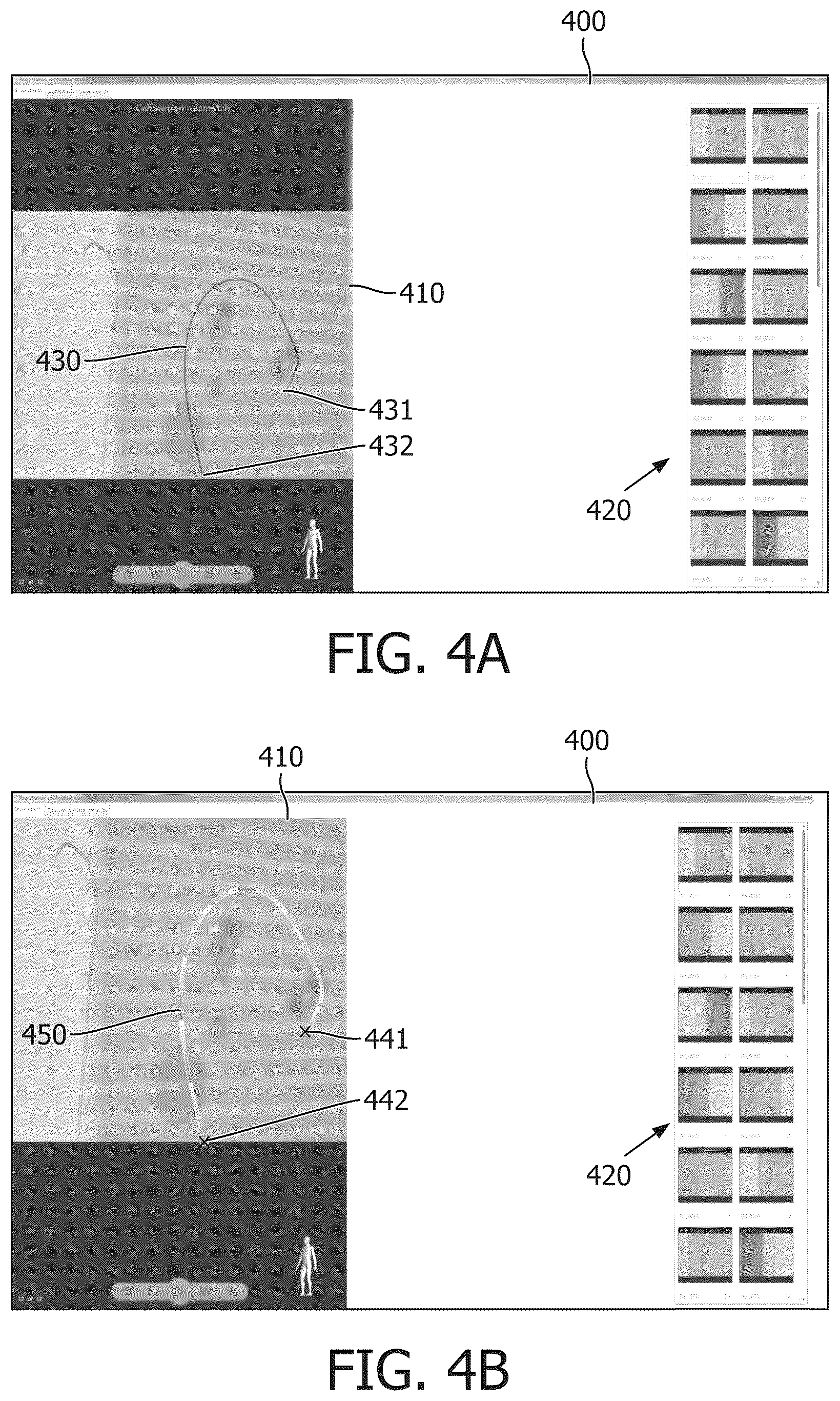 Patent US12106533 Figure 4 – Method and system for segmenting interventional device in image
