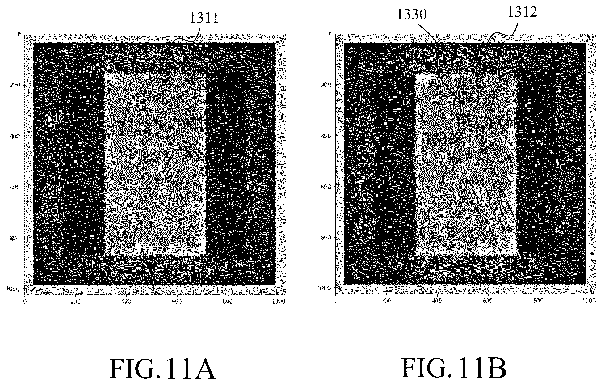 Patent US12106533 Figure 10 – Method and system for segmenting interventional device in image