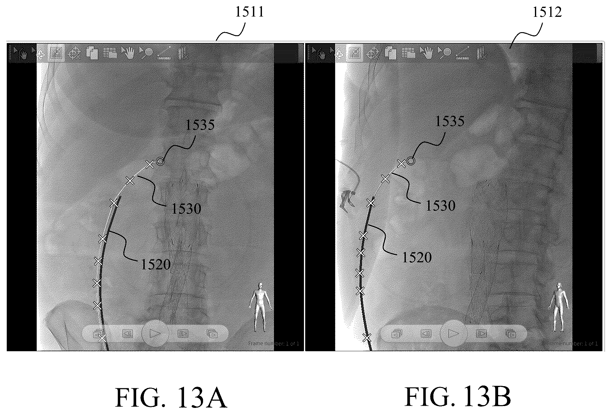 Patent US12106533 Figure 12 – Method and system for segmenting interventional device in image