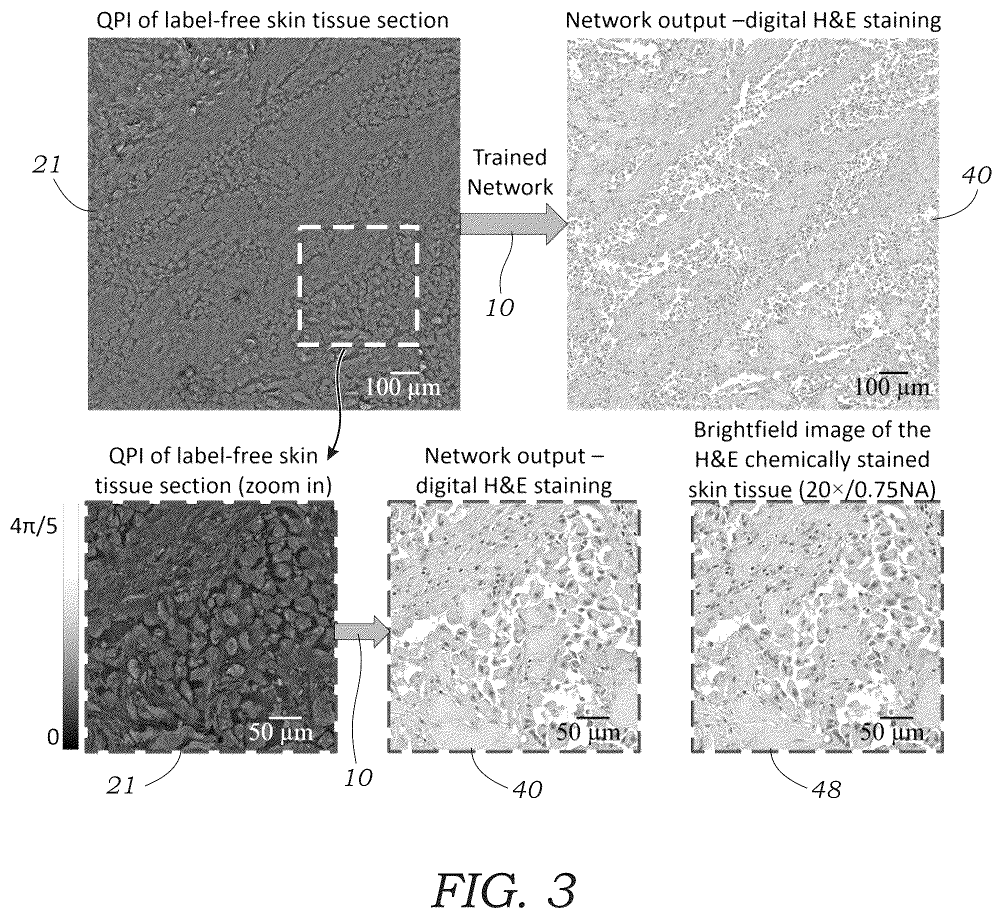 Patent US12106552 Figure 3 – Method and system for digital staining of label-free phase images using deep learning
