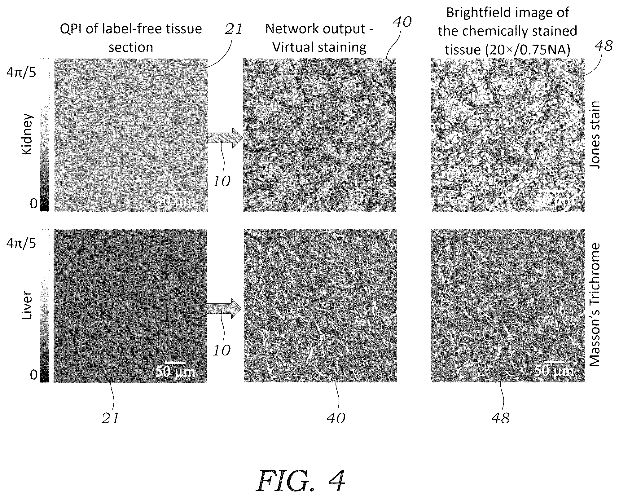 Patent US12106552 Figure 4 – Method and system for digital staining of label-free phase images using deep learning