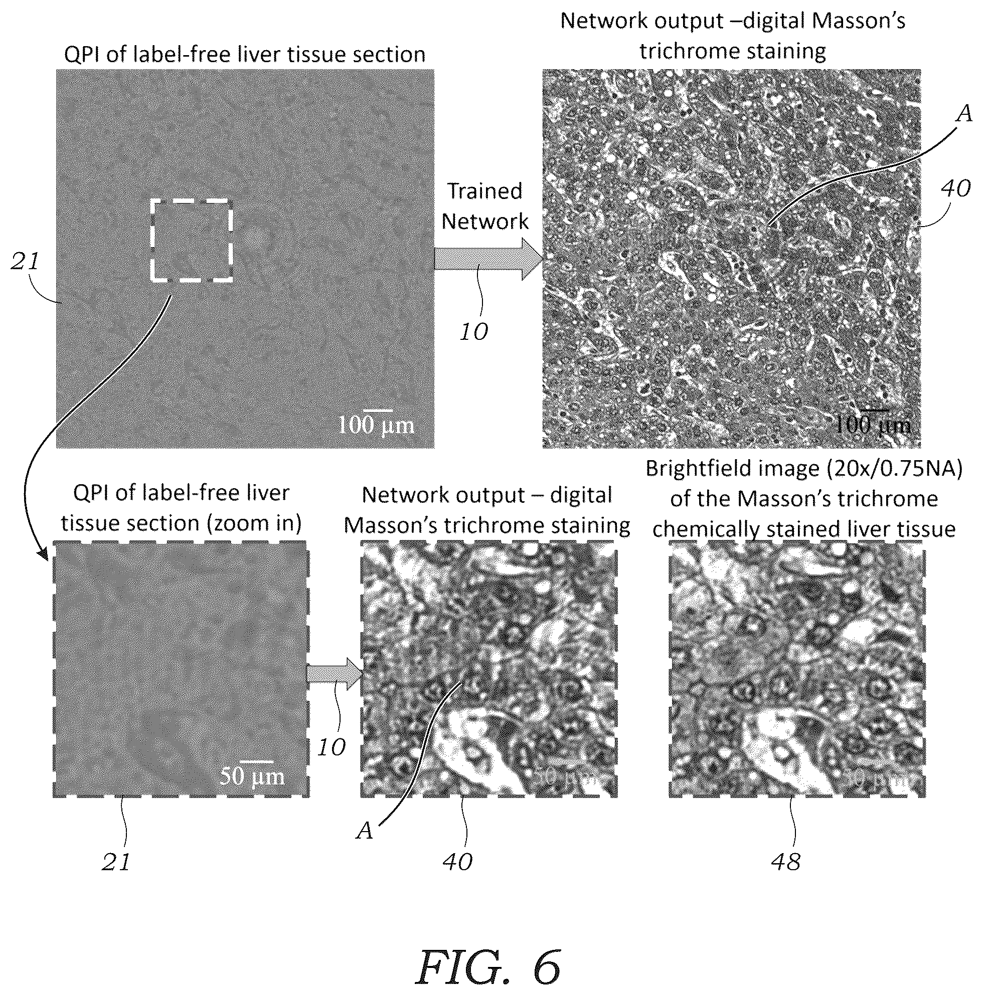 Patent US12106552 Figure 7 – Method and system for digital staining of label-free phase images using deep learning