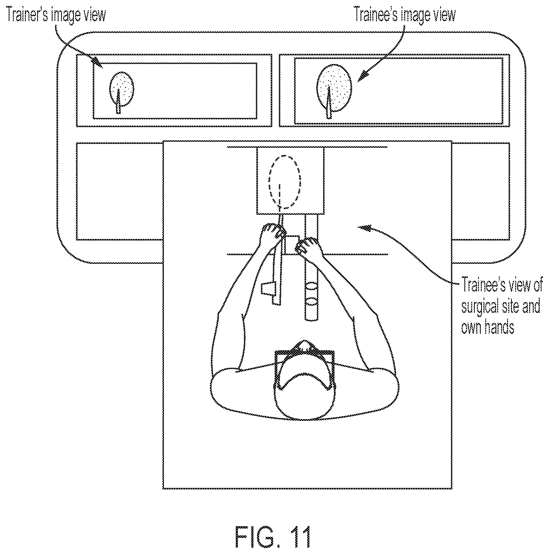 Patent US12106678 Figure 6 – Procedure guidance and training apparatus, methods and systems