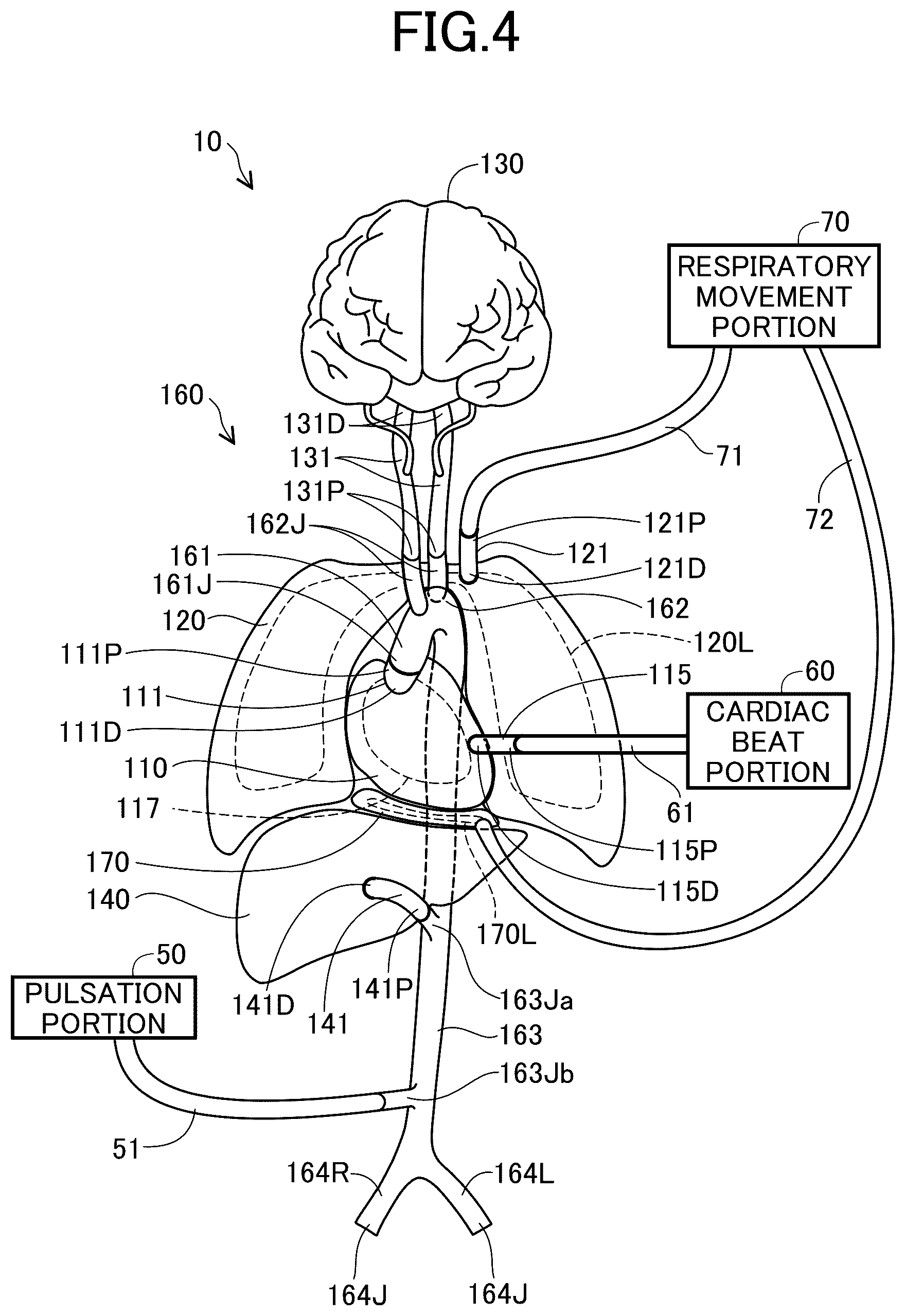 Patent US12106680 Figure 4 – Heart model