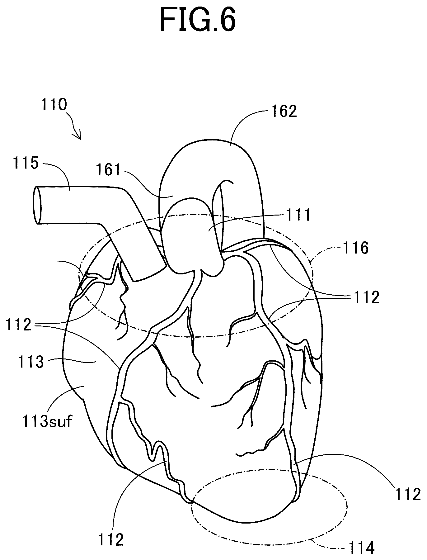 Patent US12106680 Figure 6 – Heart model