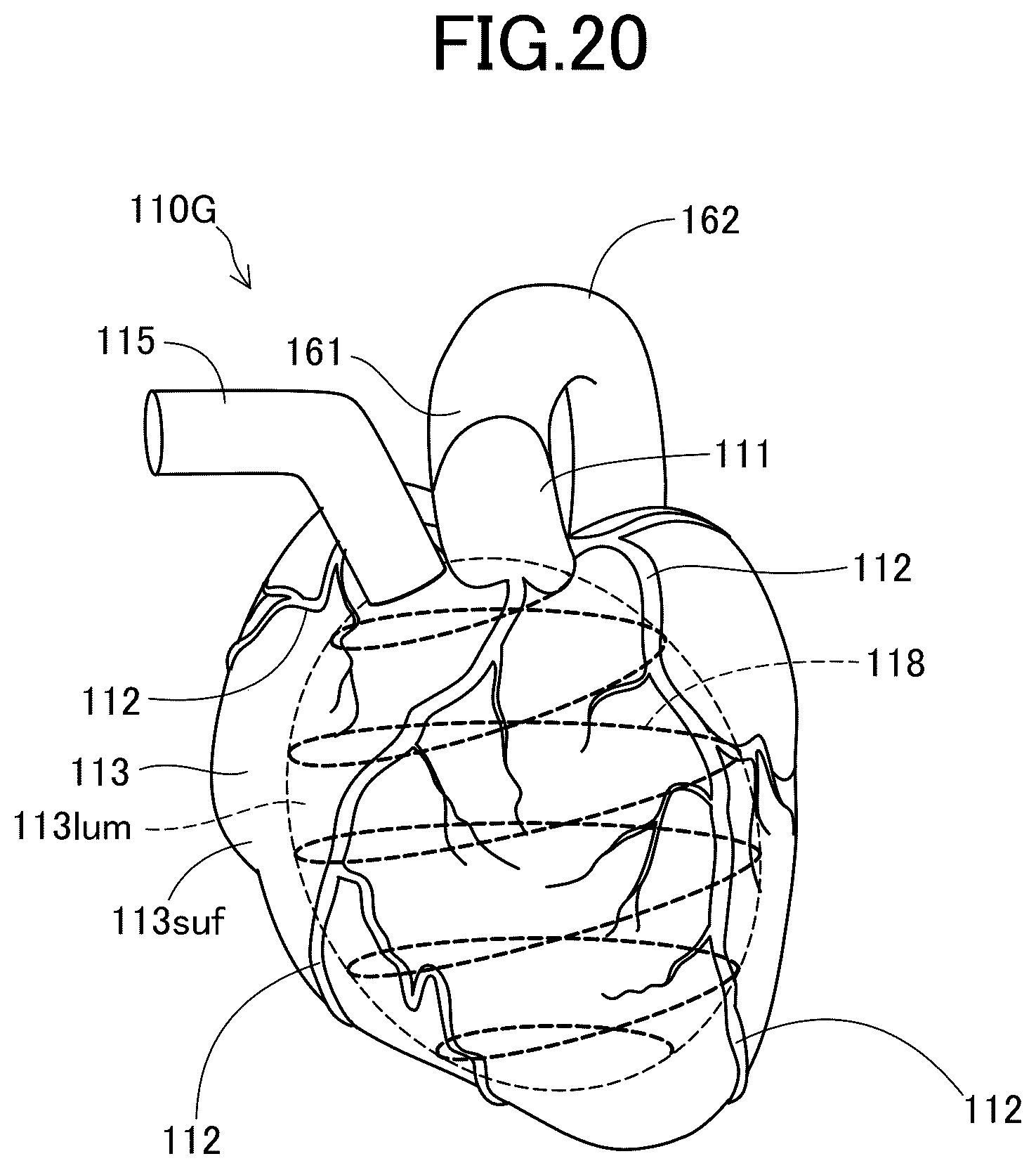 Patent US12106680 Figure 20 – Heart model