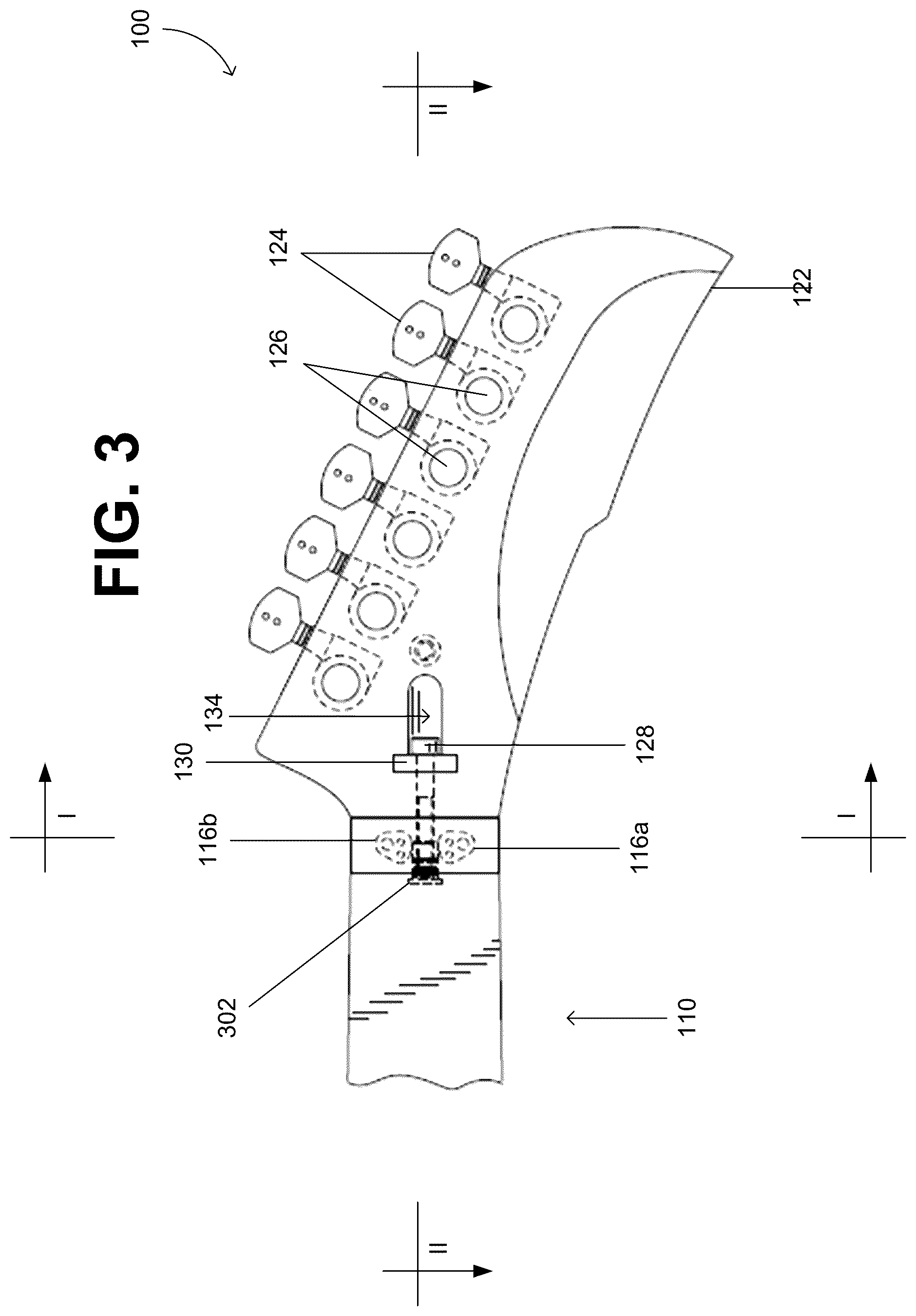 Patent US12106737 Figure 4 – Modular neck and headstock for stringed instruments
