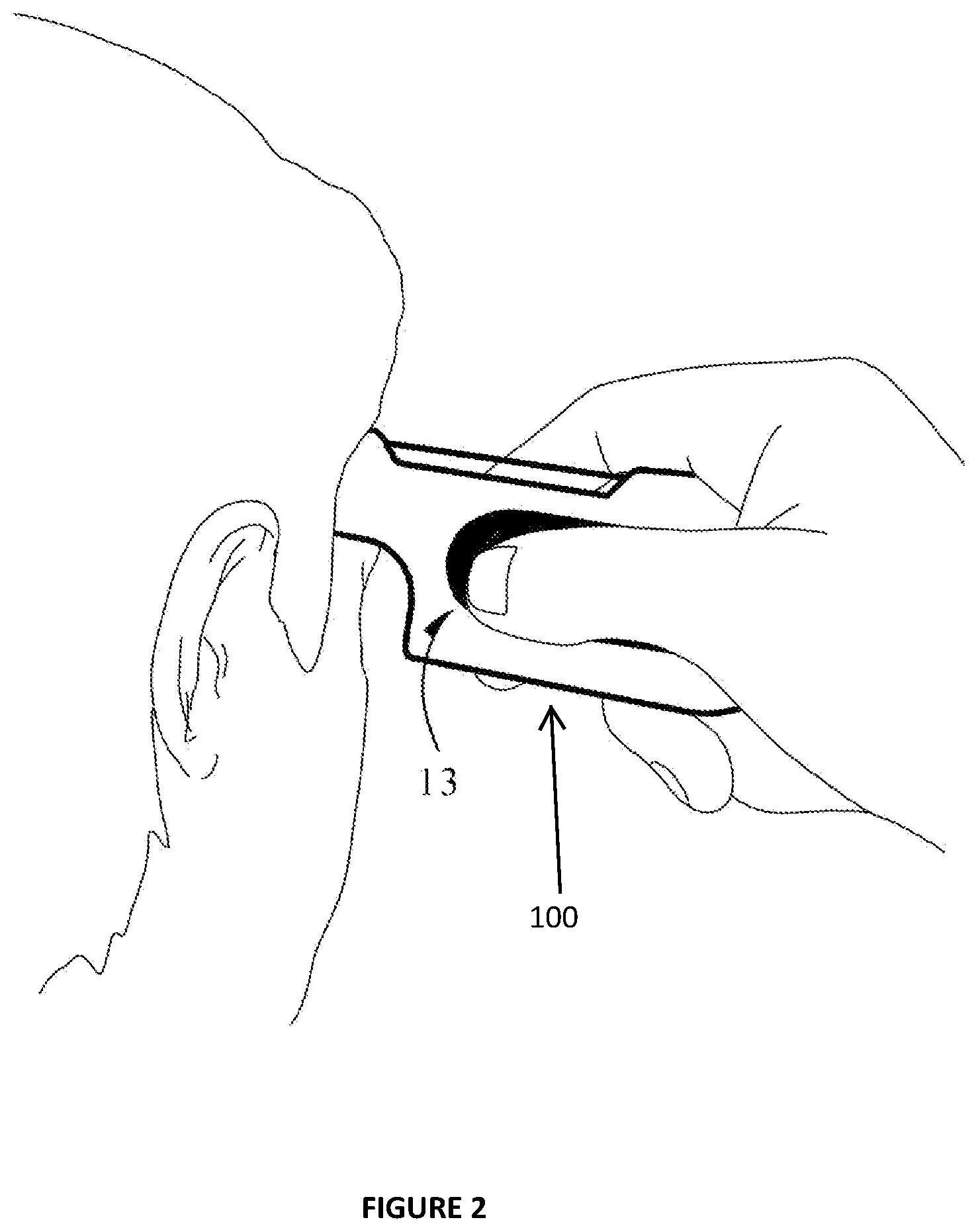 Patent US12106739 Figure 2 – Manual music generator