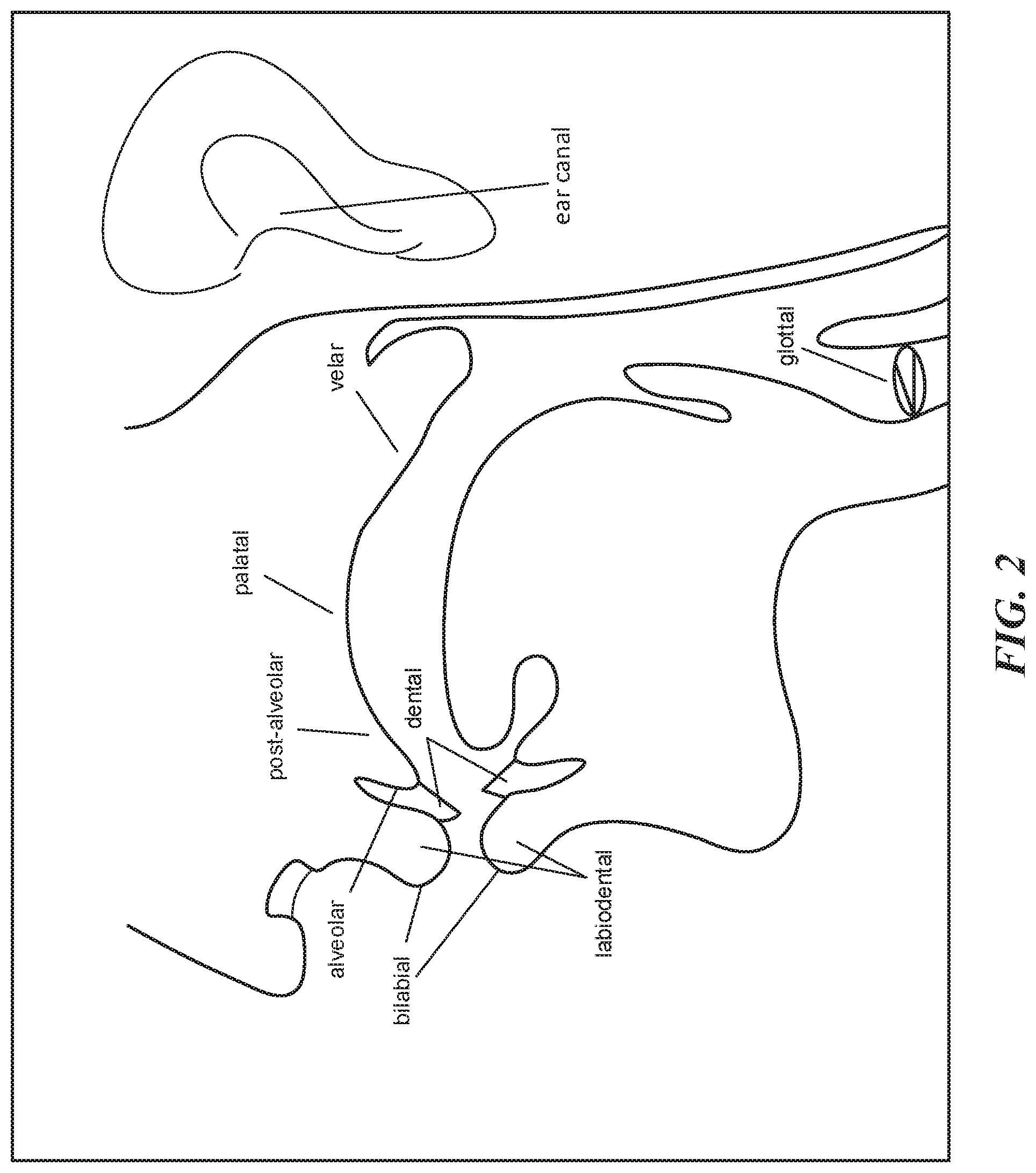 Patent US12106752 Figure 3 – Speech recognition using multiple sensors