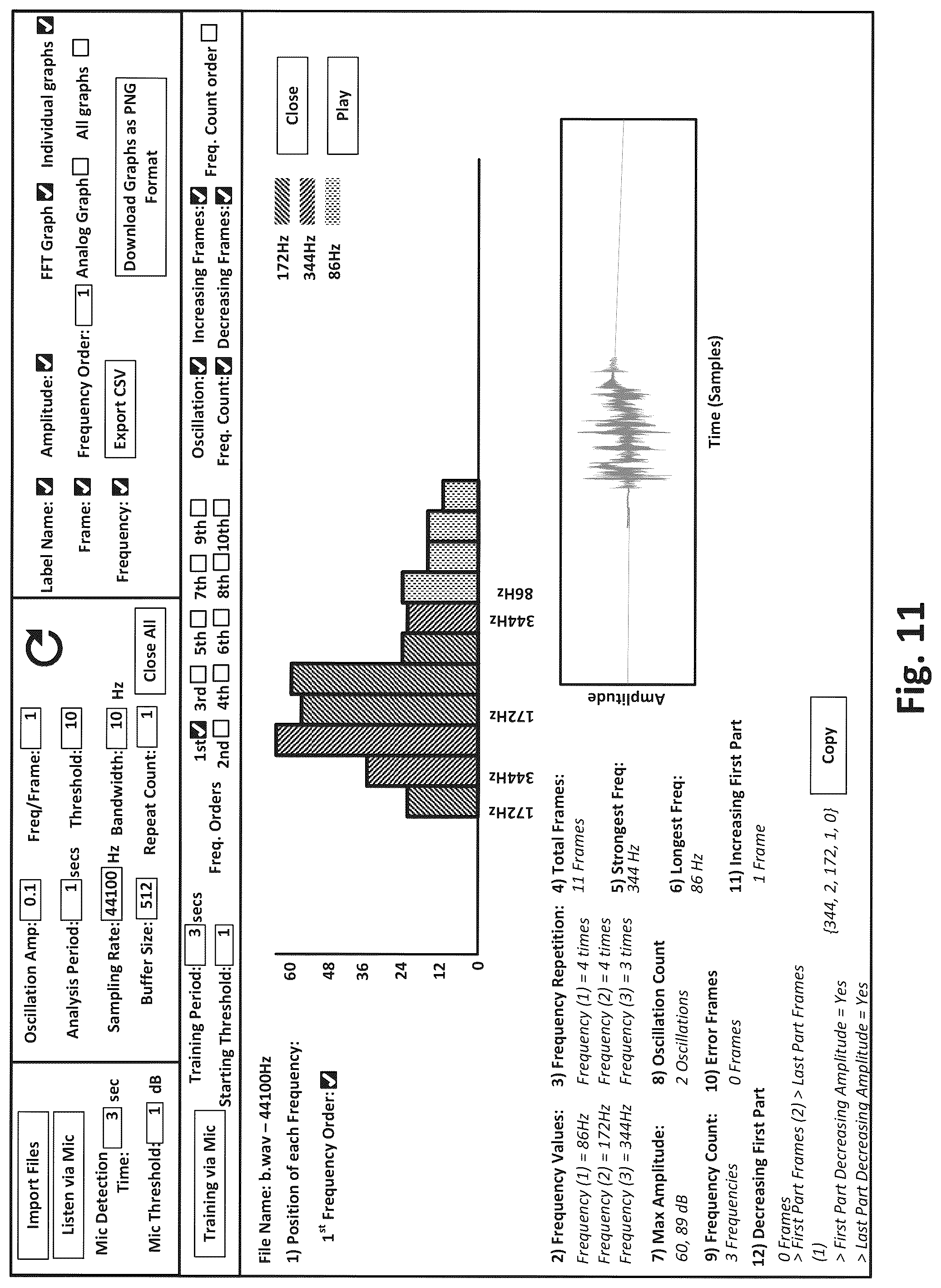 Patent US12106766 Figure 11 – Systems and methods for pre-filtering audio content based on prominence of frequency content