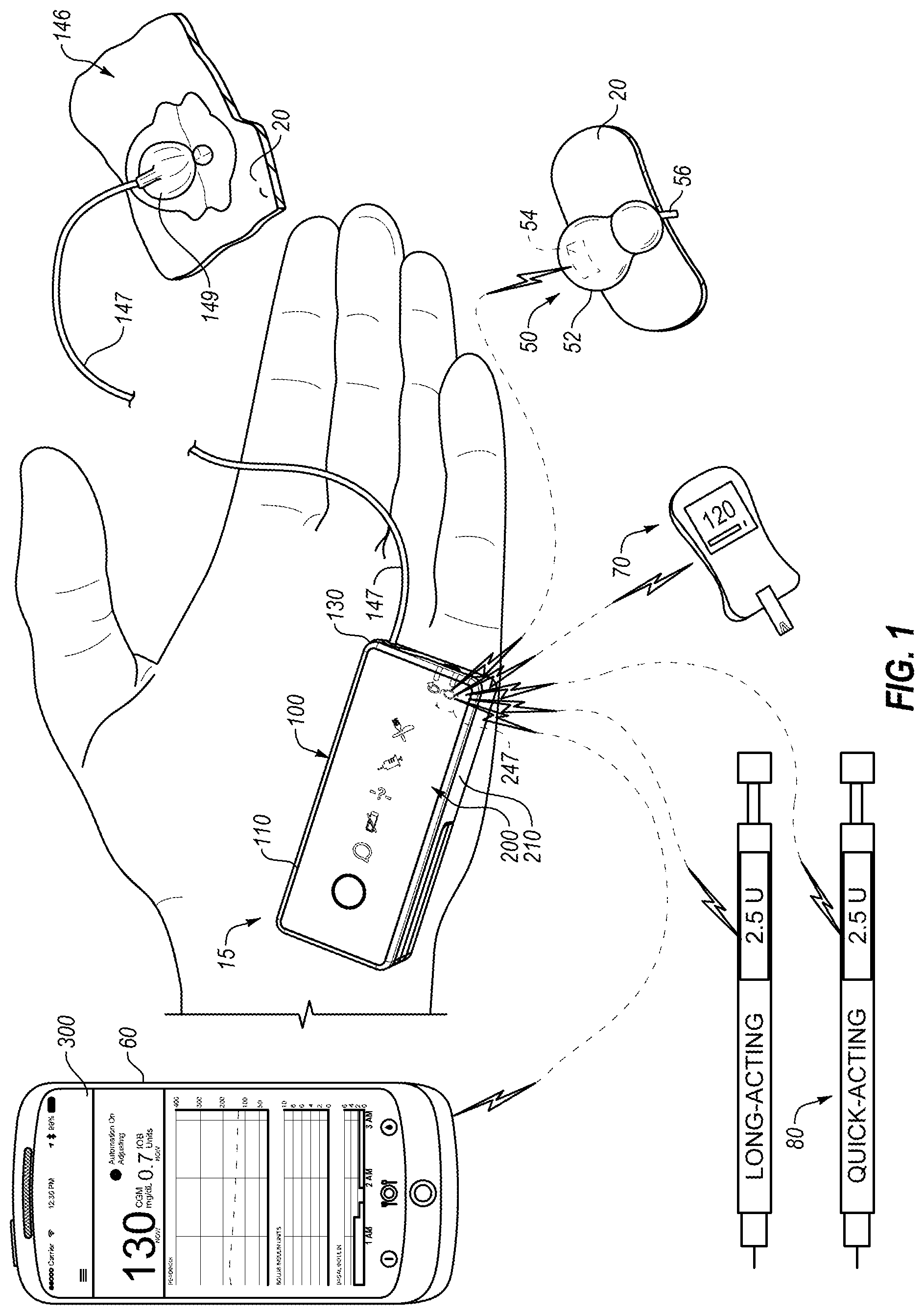 Patent US12106837 Figure 1 – Occlusion resolution in medication delivery devices, systems, and methods