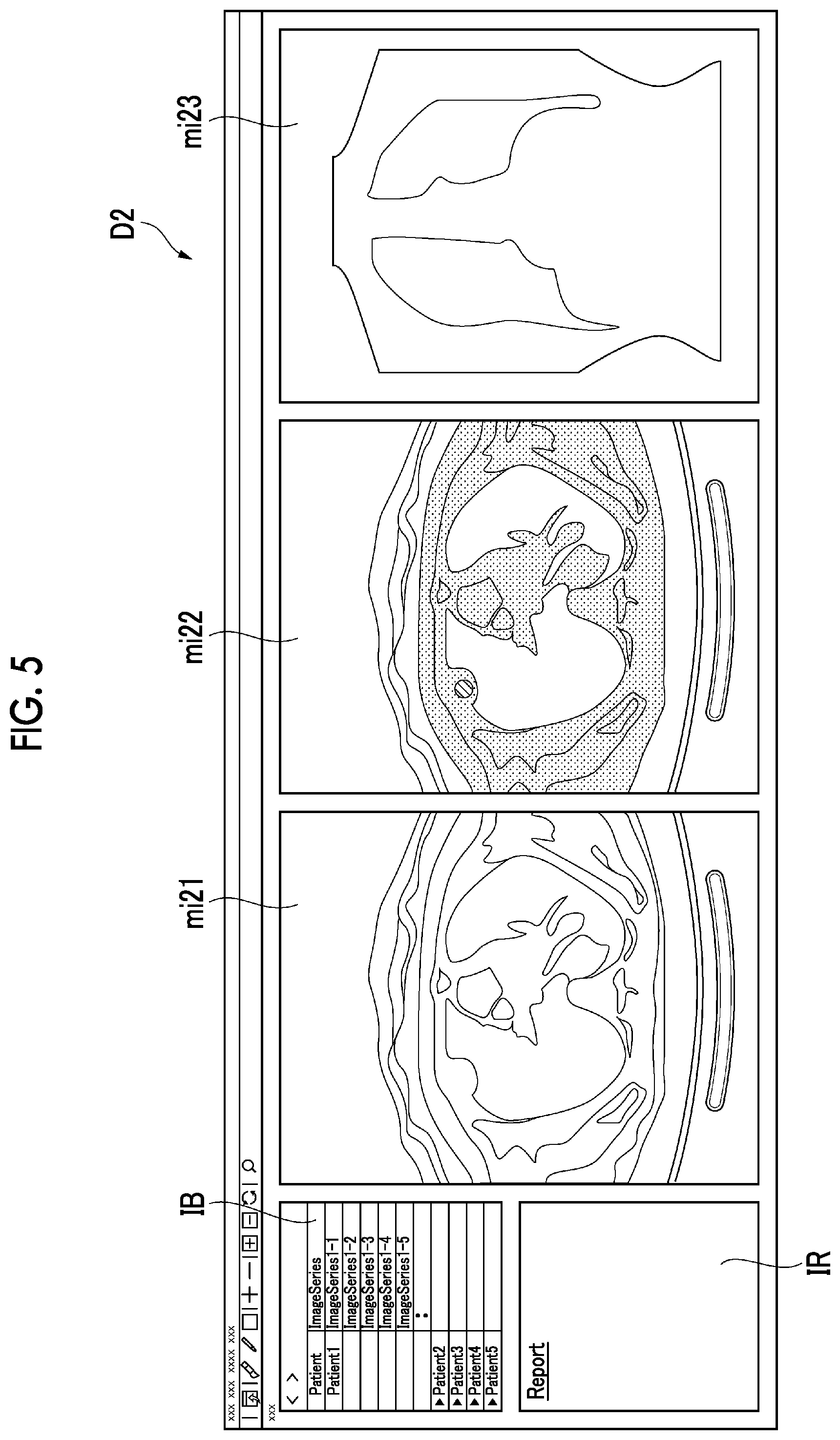 Patent US12106847 Figure 5 – Annotation support apparatus, annotation support method, and annotation support program