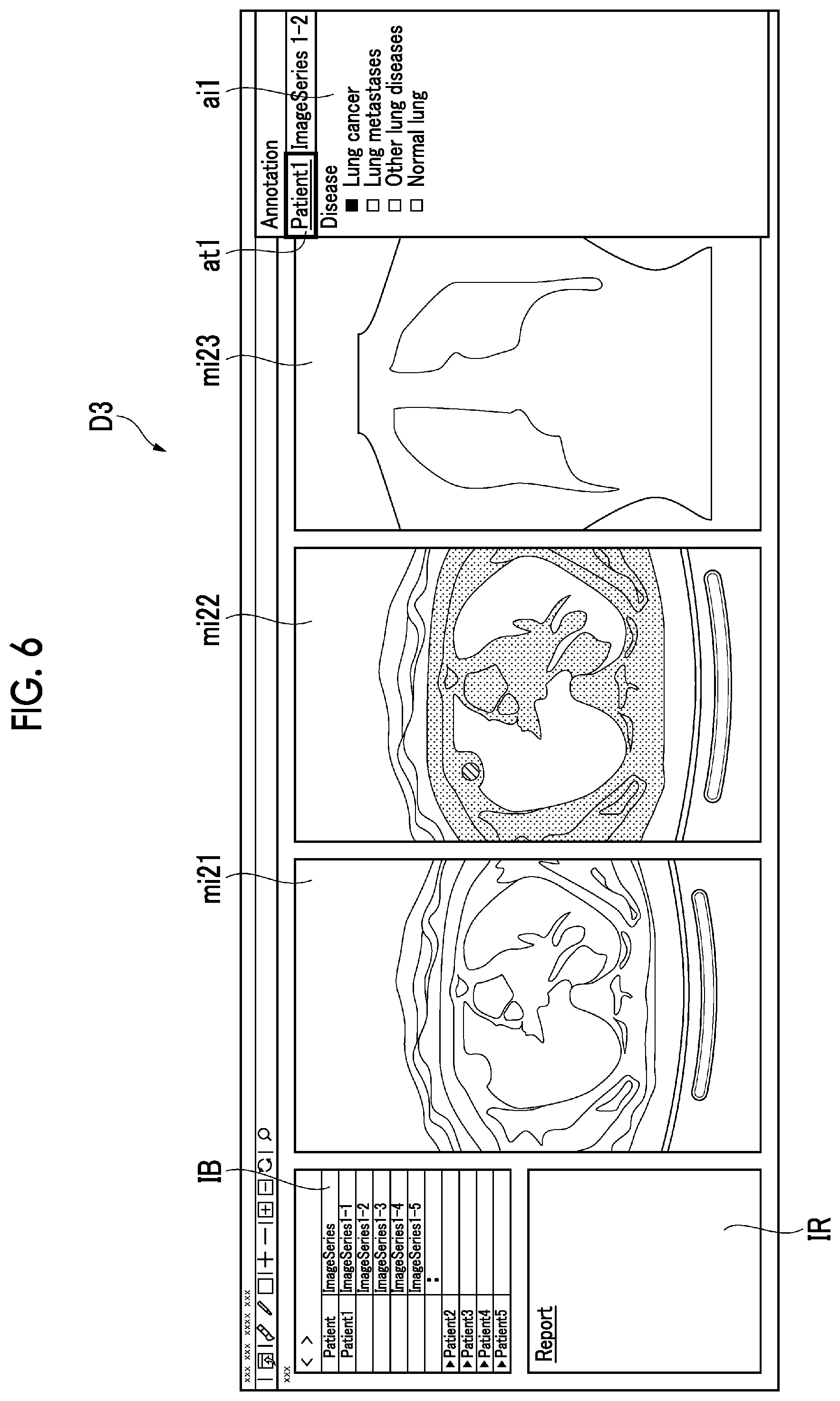 Patent US12106847 Figure 6 – Annotation support apparatus, annotation support method, and annotation support program