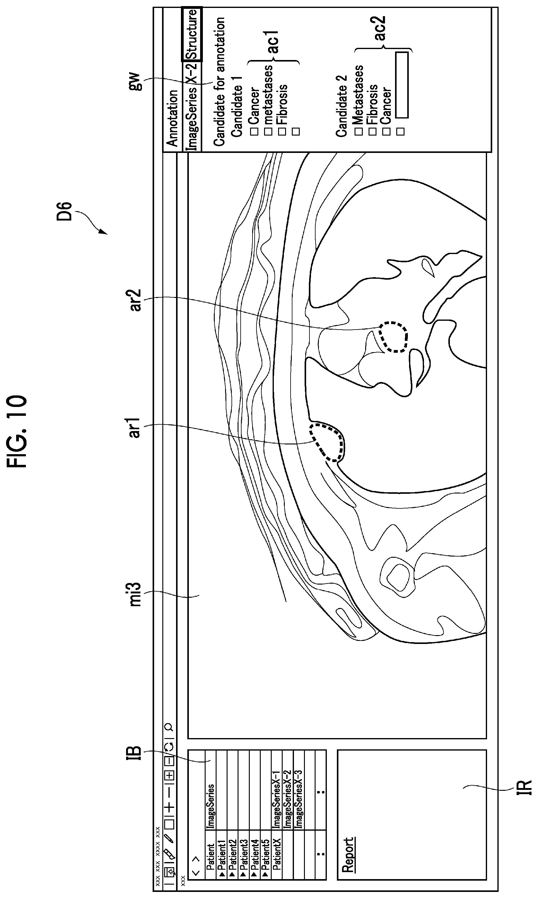 Patent US12106847 Figure 10 – Annotation support apparatus, annotation support method, and annotation support program